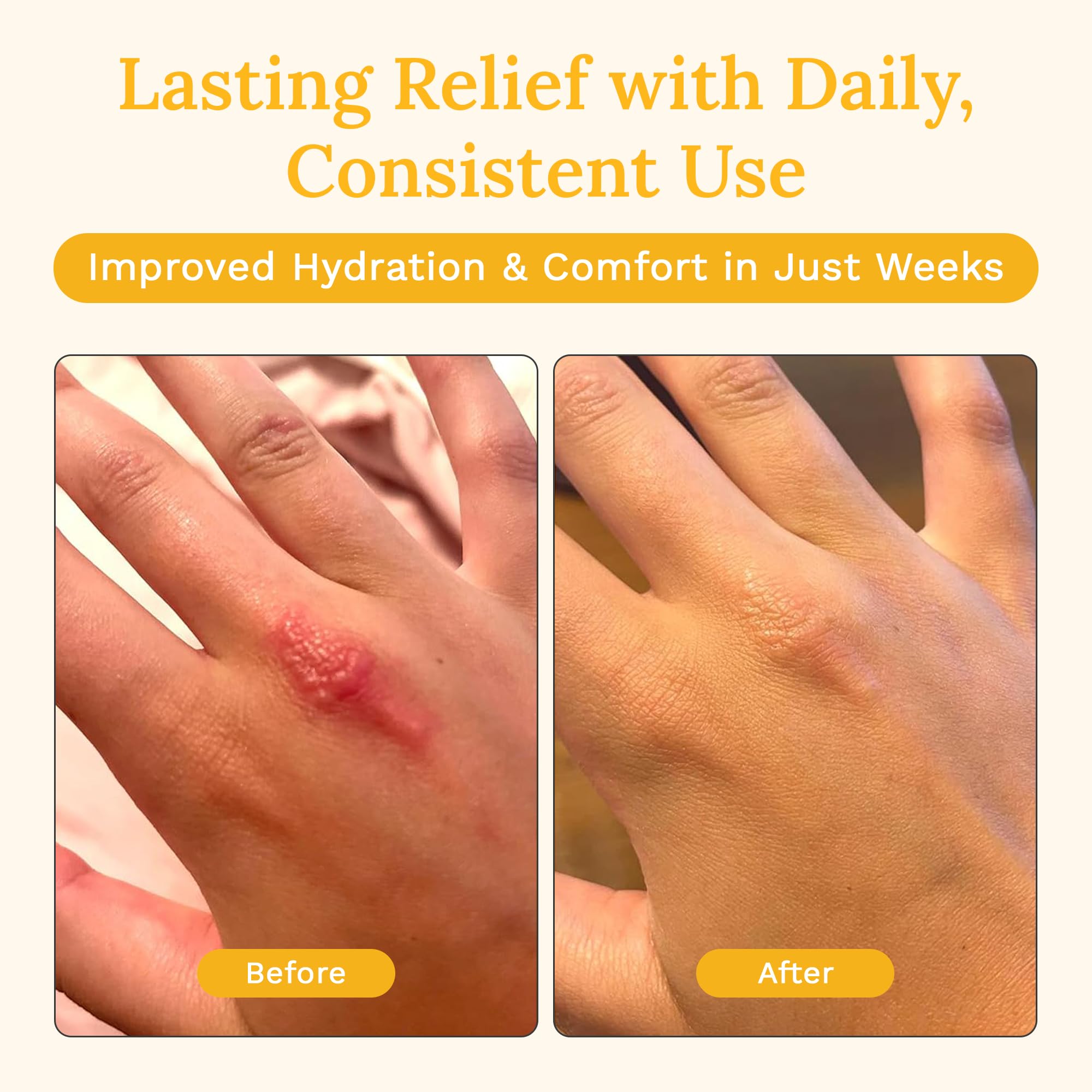 Rejuvaskin Skin Recovery Cream 100mL – Radiation & Eczema Relief