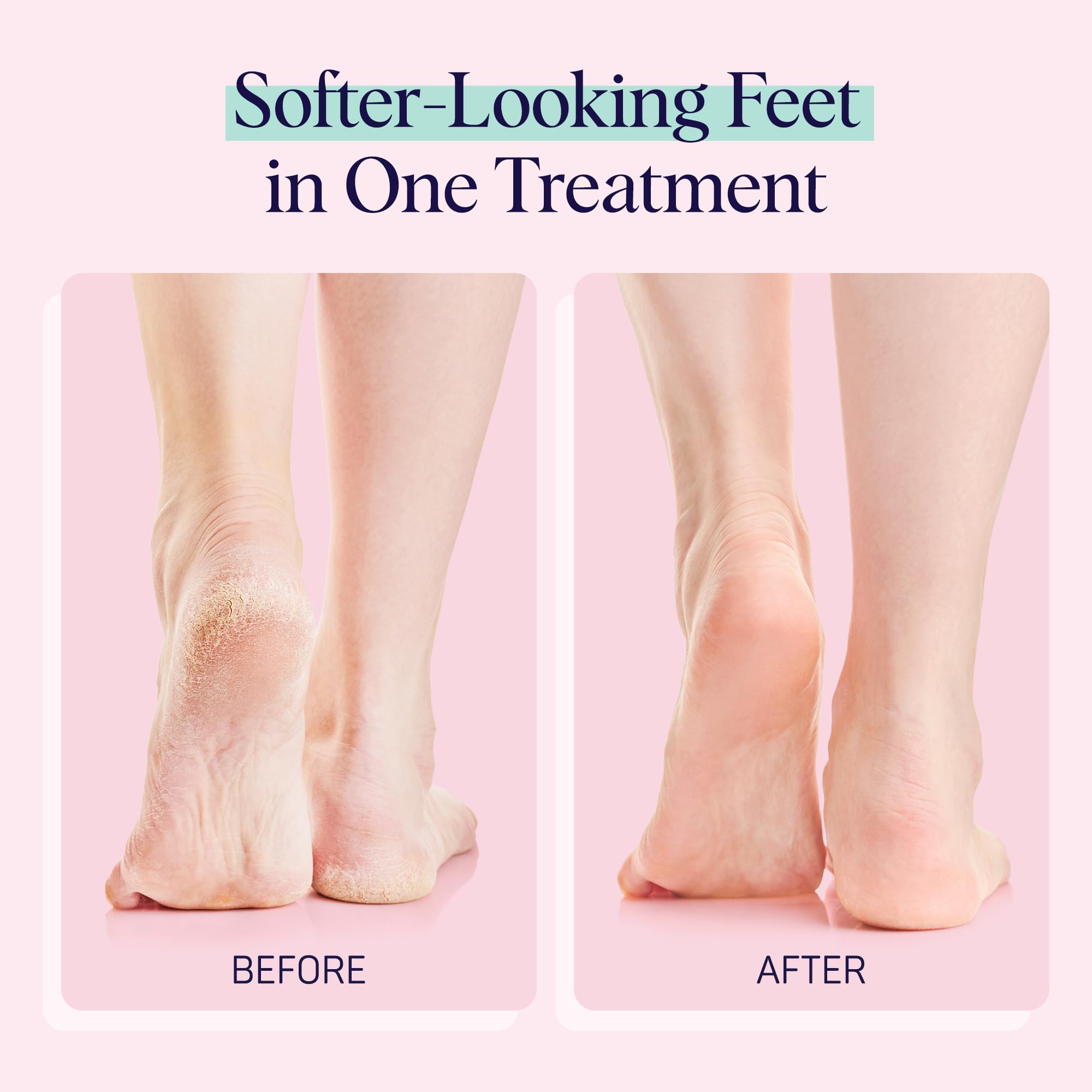 SpaLife Moisturizing Foot Sockies | Foot Mask for Dry Cracked Feet | Tea Tree Oil Softening Booties | Callus Remover Alternative | Self Care Gifts for Women | 8 Pack