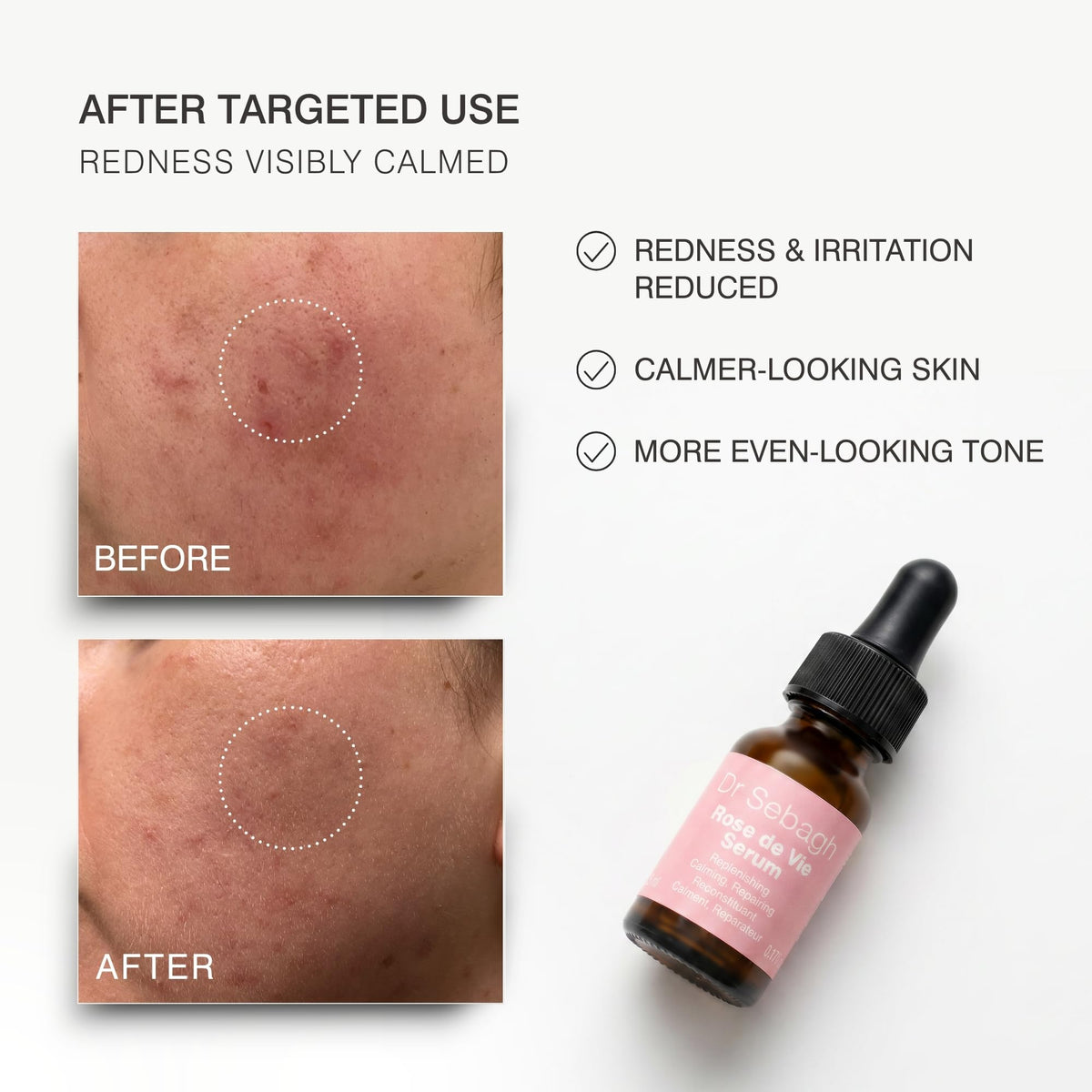 Dr Sebagh Rose de Vie Serum - Dr Sebagh Official Imagery - 4