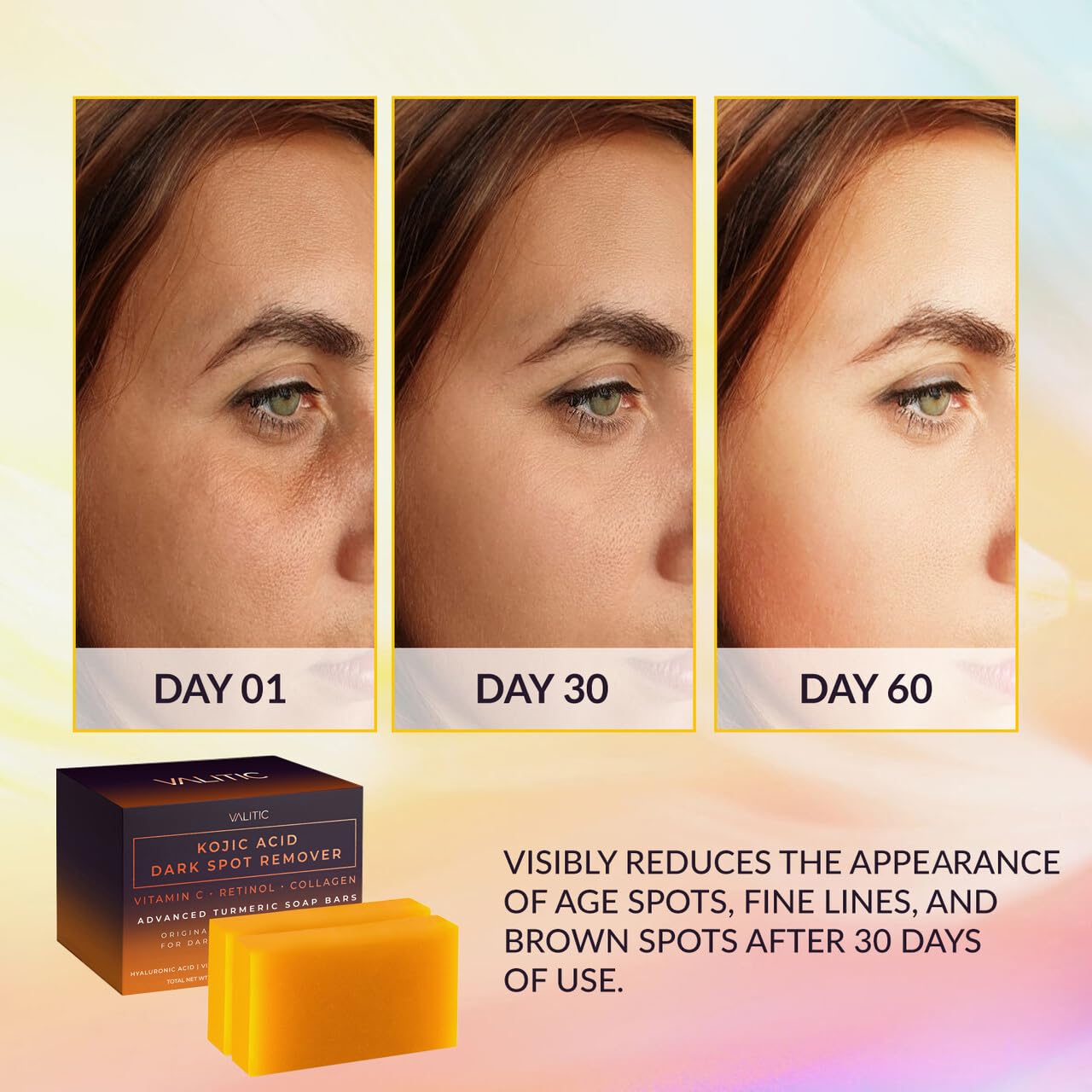 VALITIC Kojic Acid Dark Spot Remover Soap Bars 2 Pack