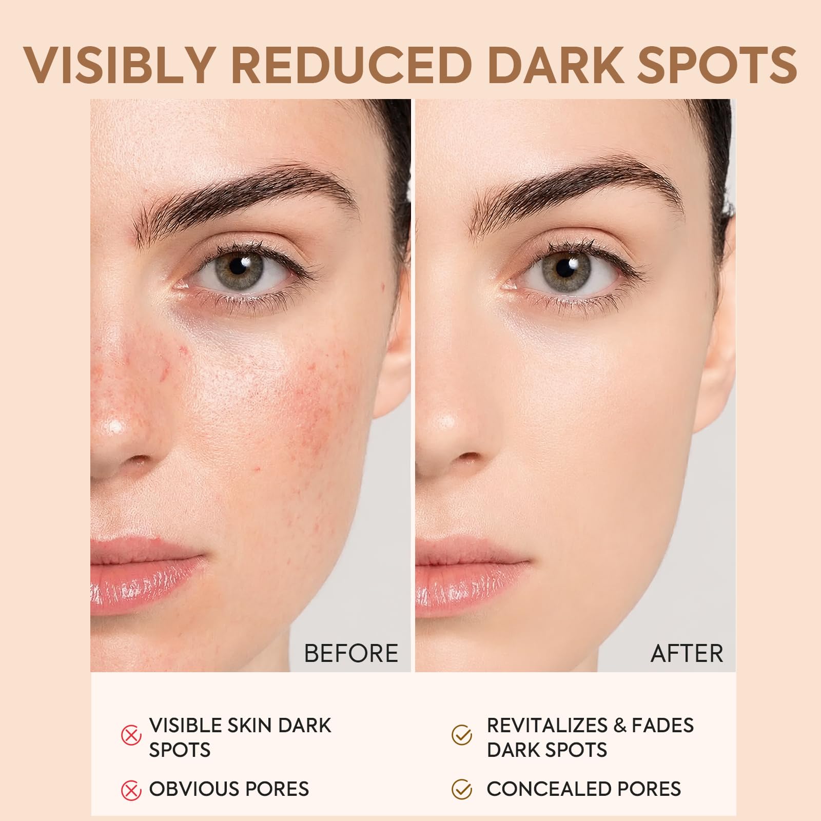 MESANDY dark spot corrector serum with niacinamide and kojic acid, featuring a sleek skincare bottle on a white background.