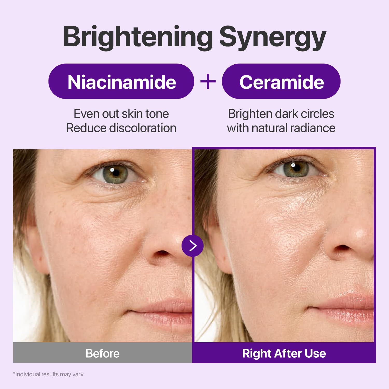numbuzin No.9 NAD+ Retinal Eye Cream for Anti - Aging & Strawberry Skin & Firmer Skin - numbuzin Official Product View 5