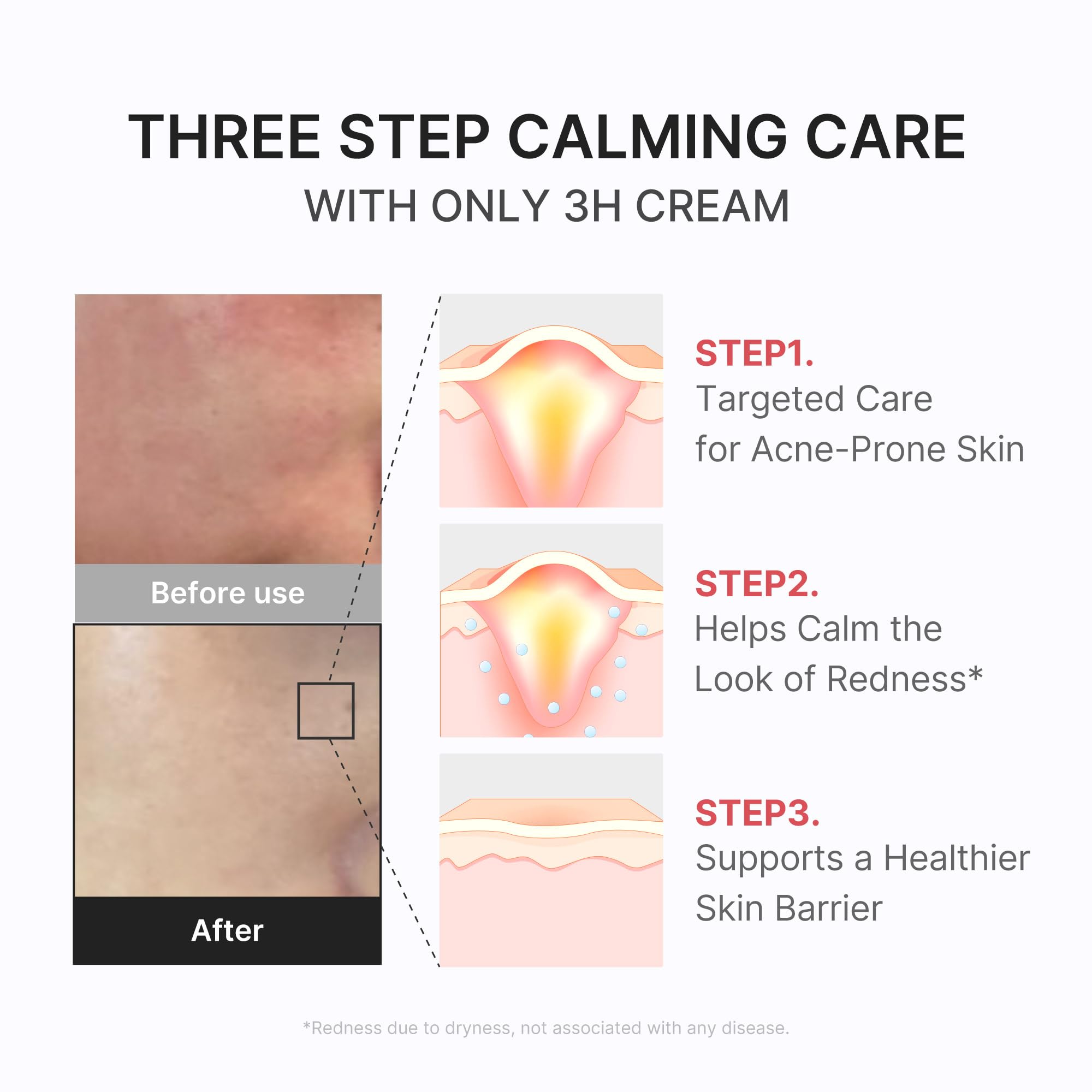 medicube 3H Daily Relief Cream for All Skin Types & After Spot Care - medicube Official Product View 5