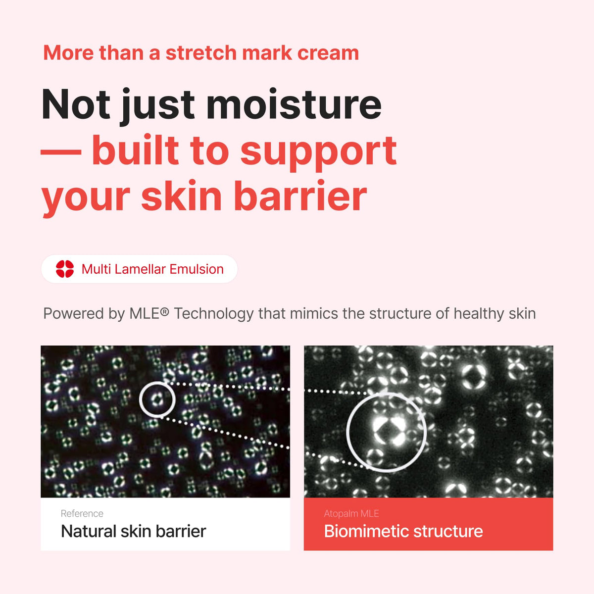 ATOPALM Maternity Care Stretch Mark Cream 150ml 5 Fl Oz - ATOPALM Official Product Imagery - 6