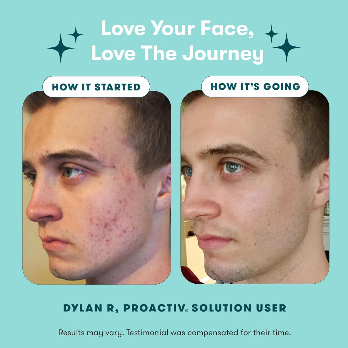 Proactiv 3 Step Acne Treatment w Pimple Patches - Proactiv Official Imagery - 7