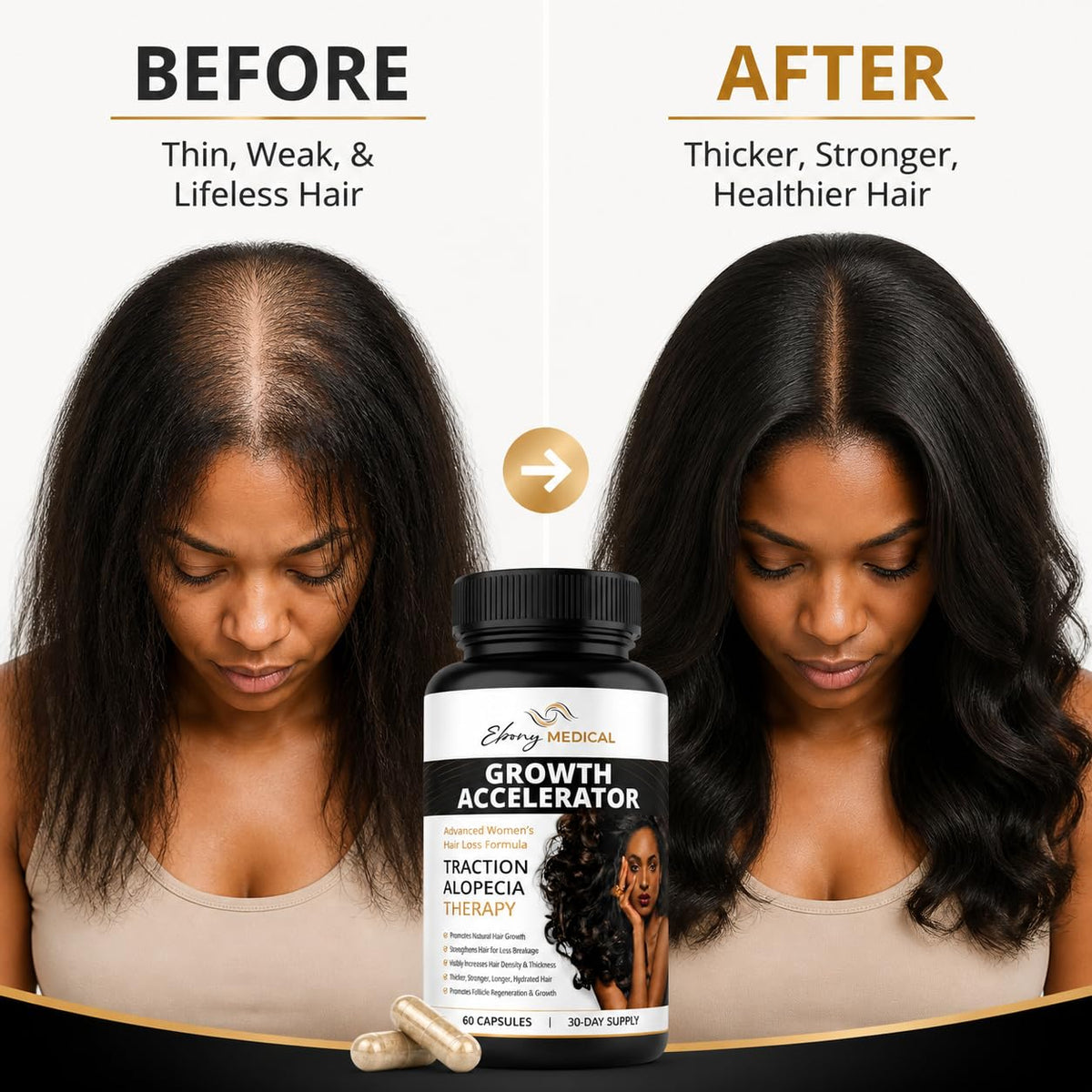 Ebony Medical Hair Growth Supplement Women Keratin Vitamins - Natural Curves Official Imagery - 3