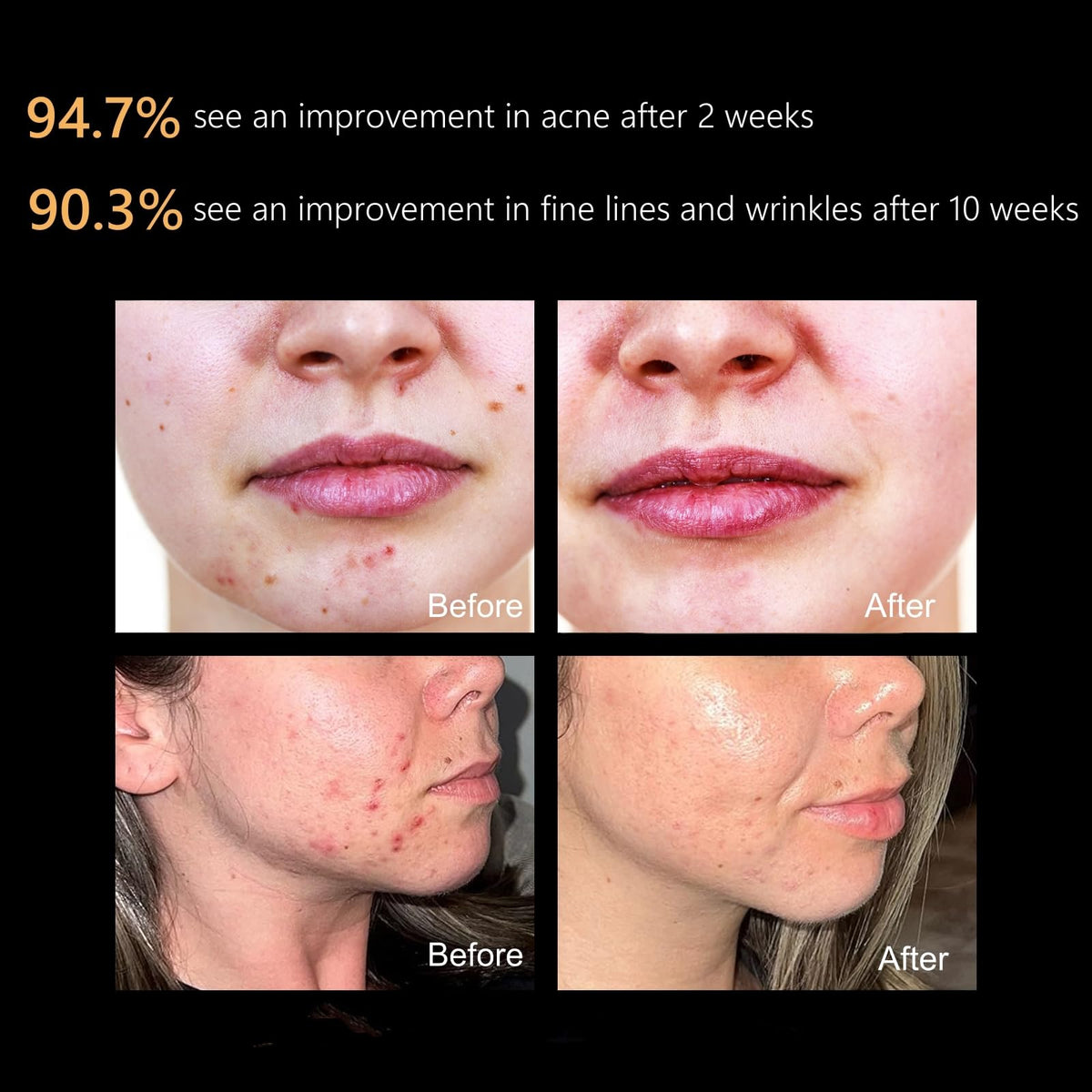 Aphrona FDA cleared LED Facial Mask MOONLIGHT PRO 7 Color - Aphrona Official Imagery - 5