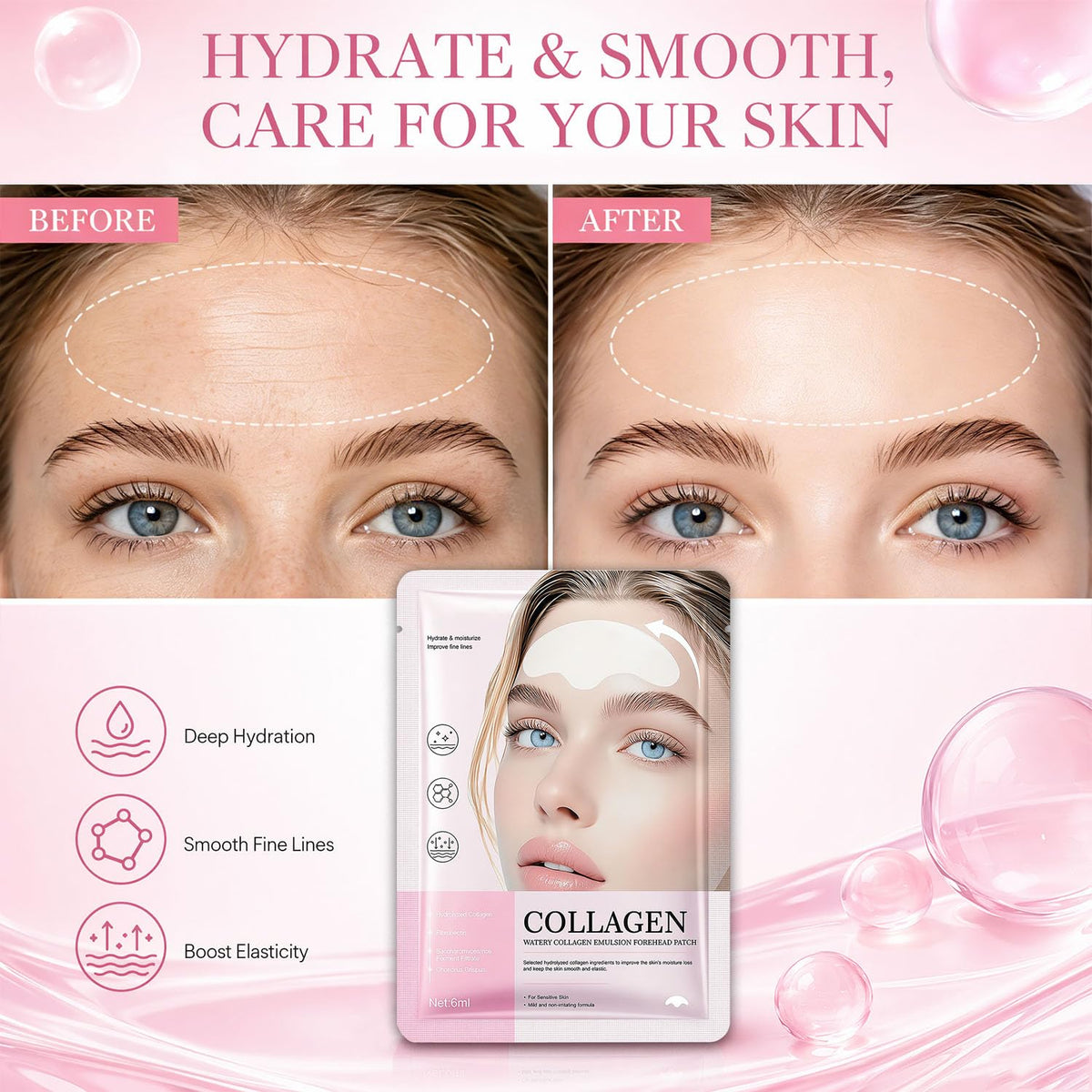 10Pcs Forehead Wrinkle Patches Forehead Wrinkles Treatment - Petramrs Official Product Imagery - 7