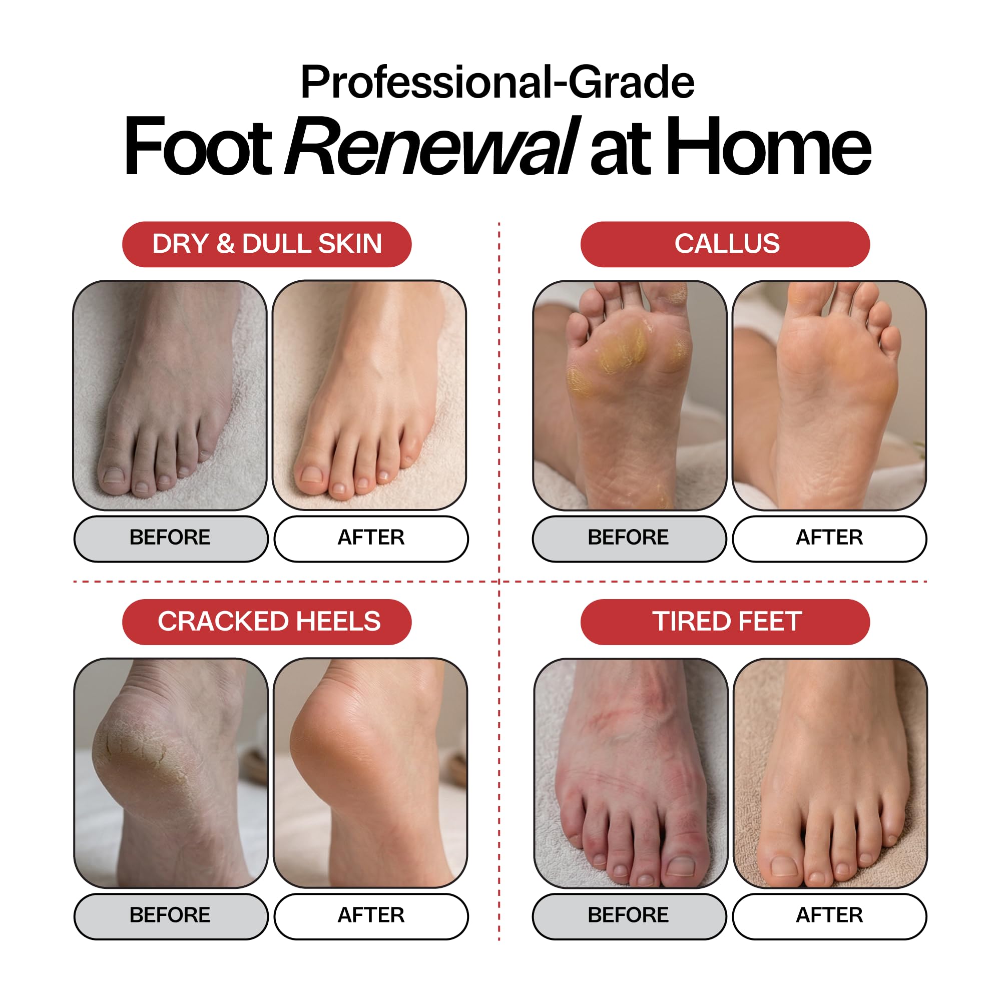 Foot Choice Epsom Salt Foot Soak – Arnica & Peppermint 1lb