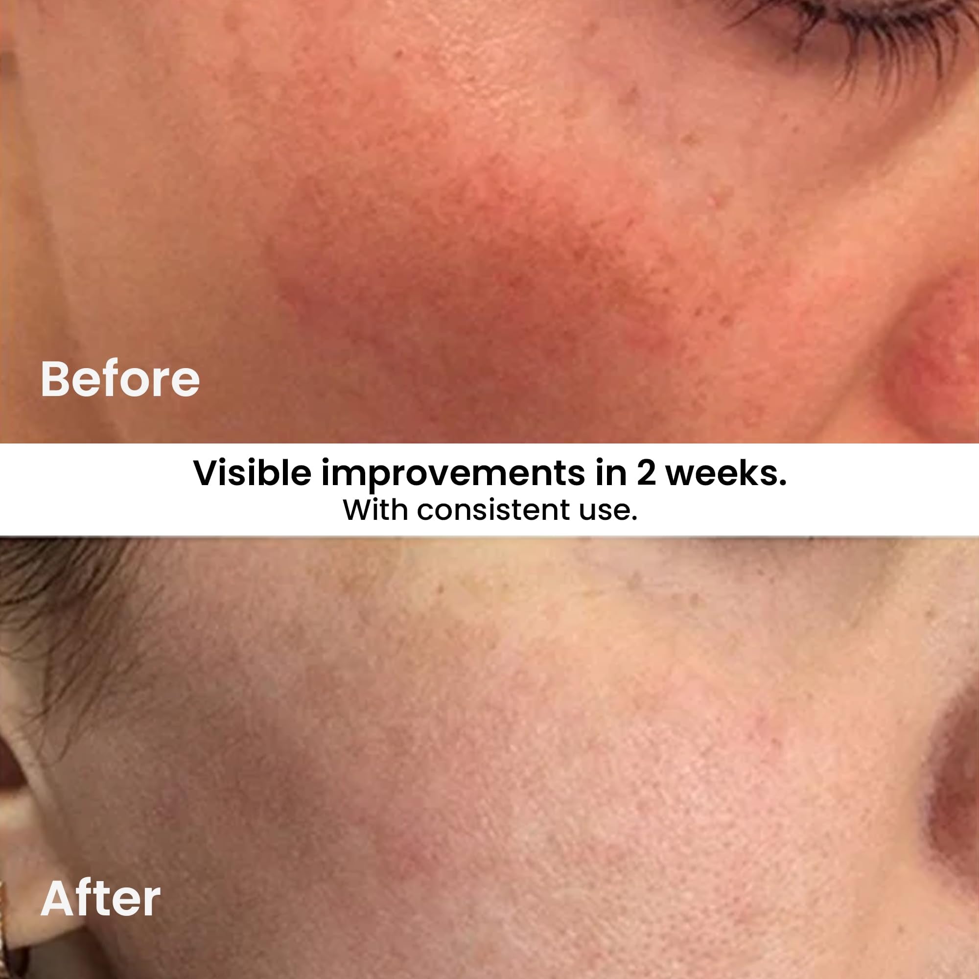 Kleem Organics Kleem Vitamin C Serum for Face - Anti Aging & Brightening - Kleem Organics Official Product View 6