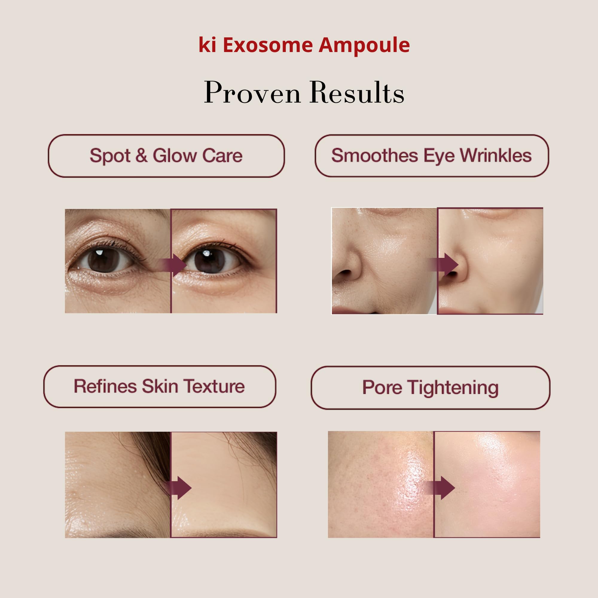 Stem-Cell Exosome Skin Booster Kit Booster Ampoule - ki cosmetics