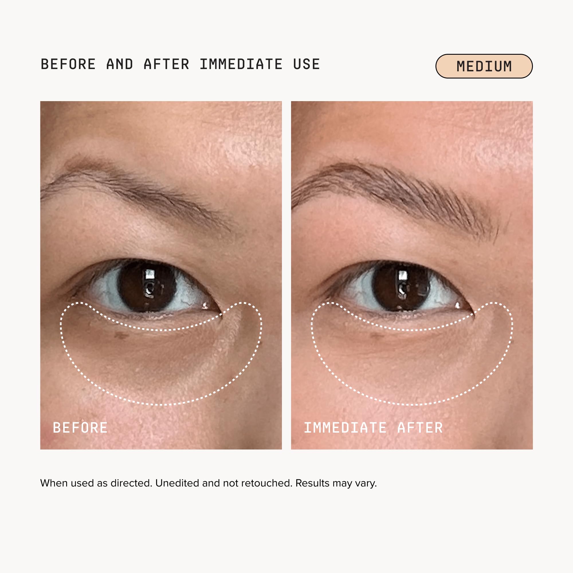 DRMTLGY Luminous Eye Corrector SPF 41 Medium - DRMTLGY Official Imagery - 4