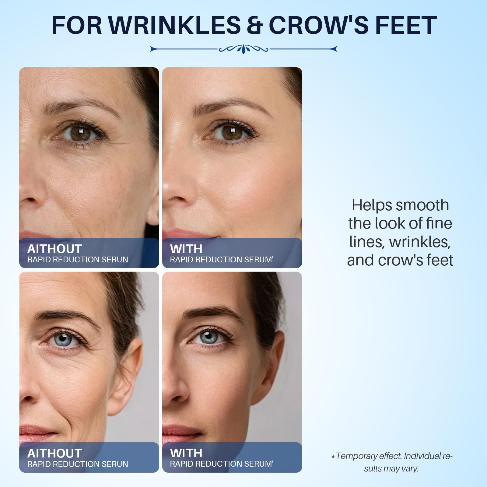 Instant Lift Eye Serum for Dark Circles Puffiness Anti Bag - meisiuri Official Imagery - 4