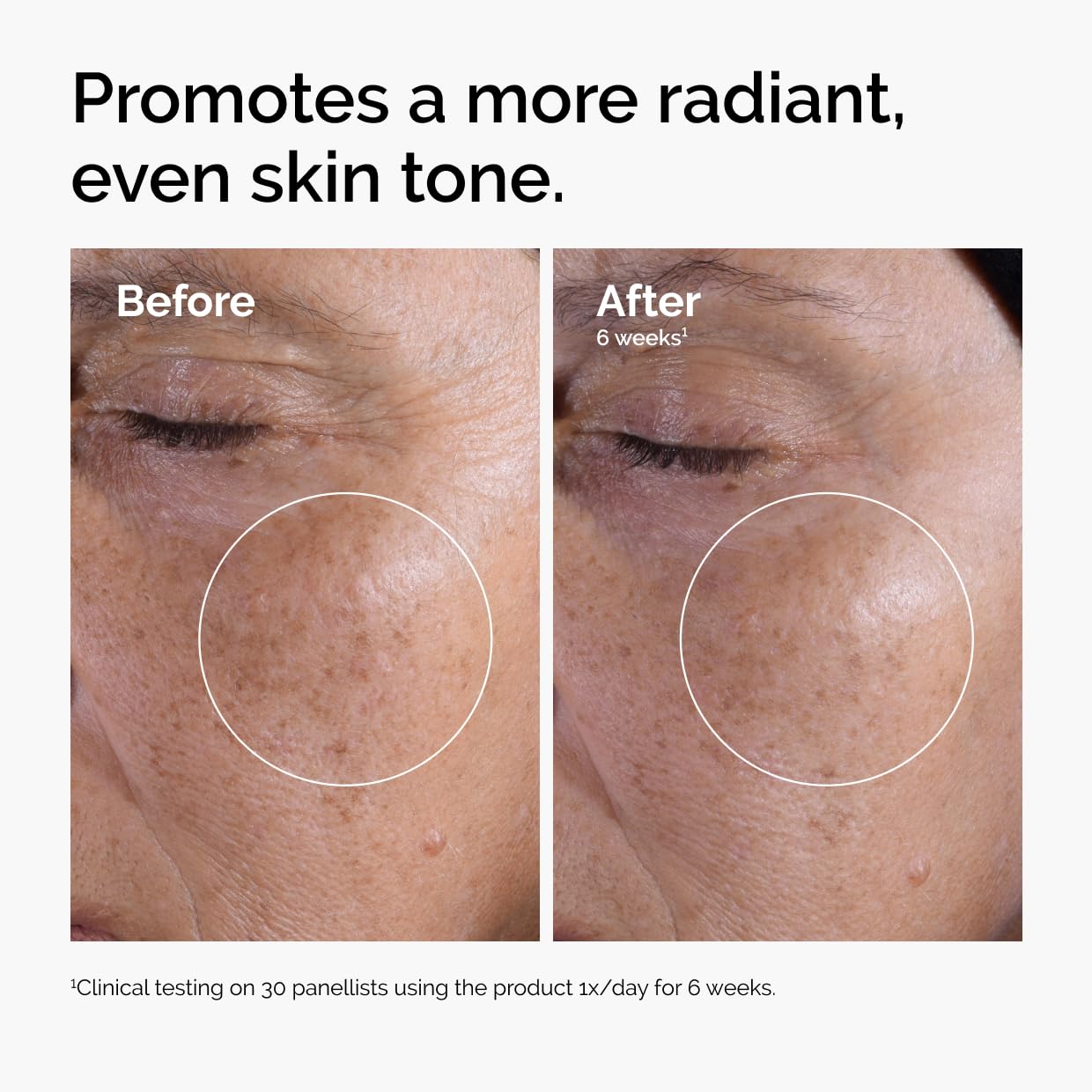 The Ordinary Glycolic Acid 7% Exfoliating Toner, Brightening a... - Elefair Tech Official Product View 3