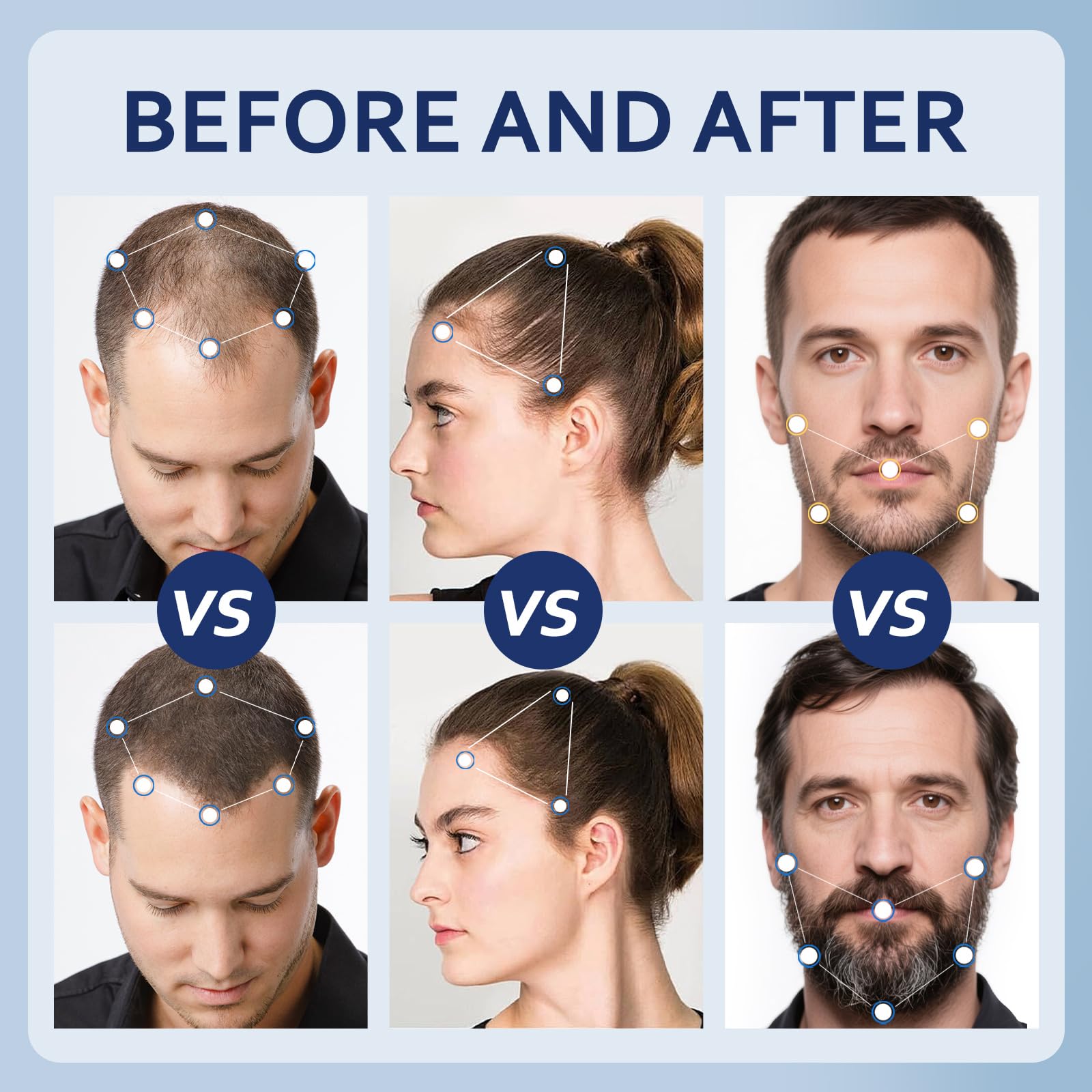 Artimore 5% Minoxidil Hair Growth Serum with Biotin - Minoxidil and Women & 5 - Artimore Official Product View 5