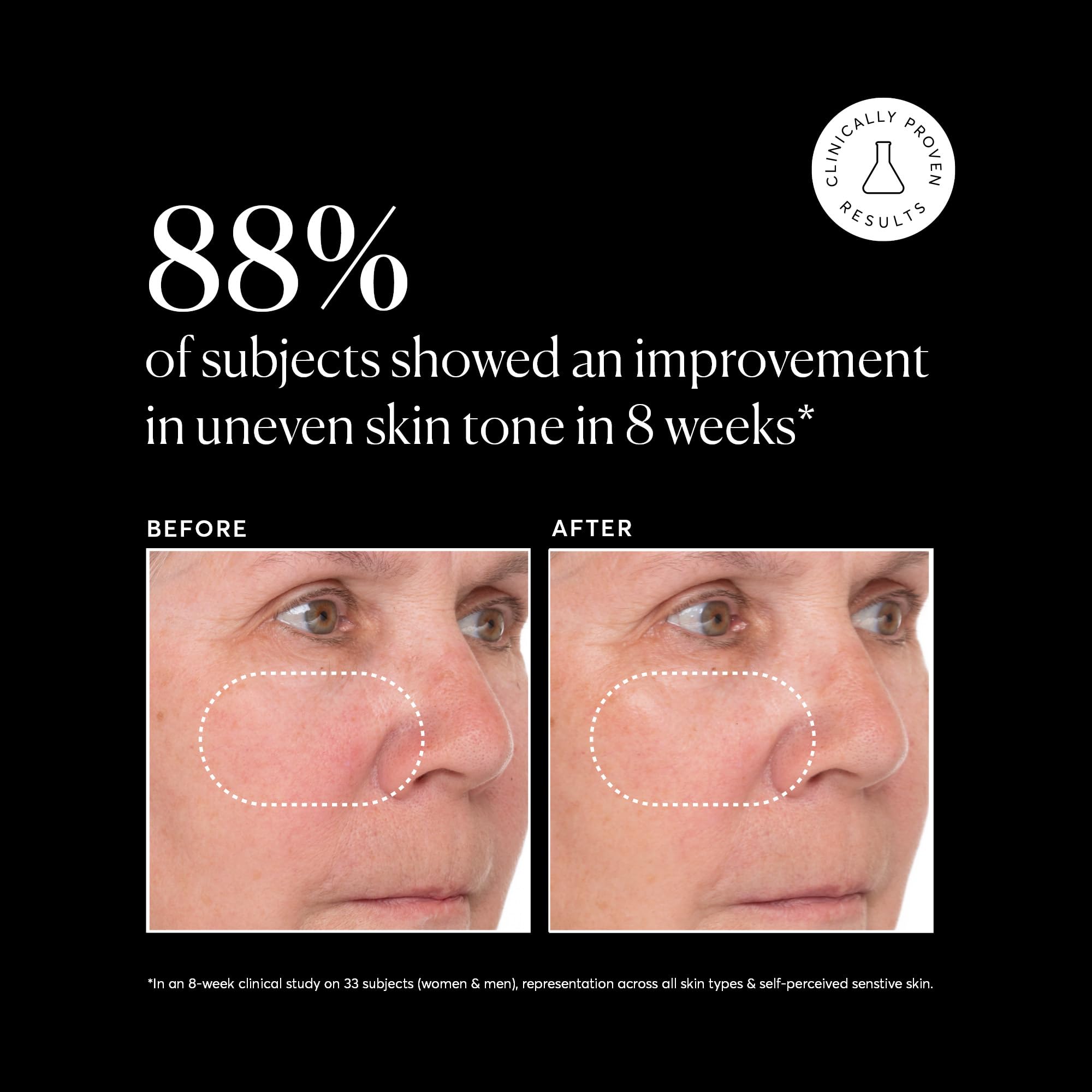 Naturium Vitamin C Super Serum Plus Jumbo Smoothing Face - Naturium Official Imagery - 6