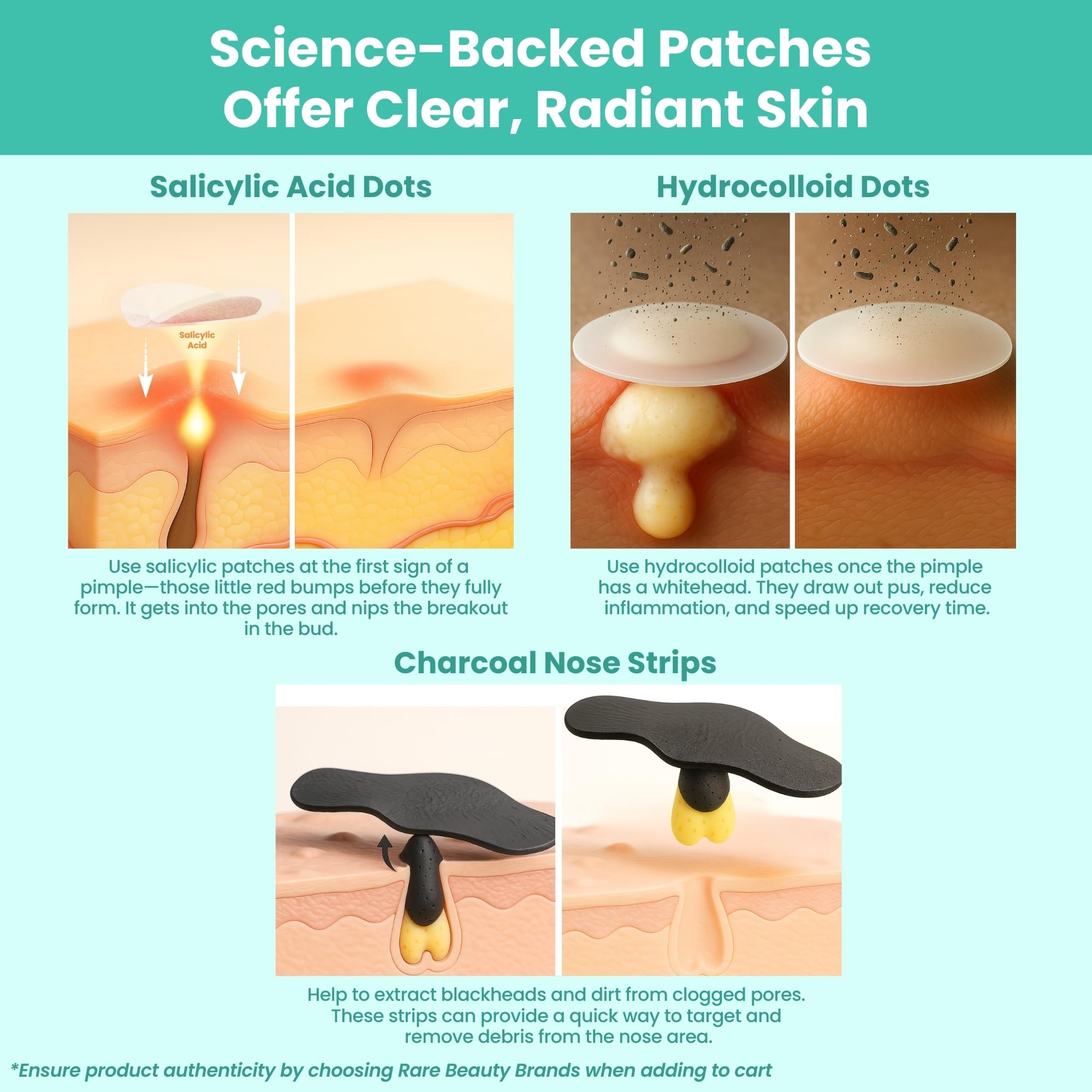 Patchology Breakout 3 in 1 Acne Pimple Patch Kit 3 Nose - Patchology Official Imagery - 4