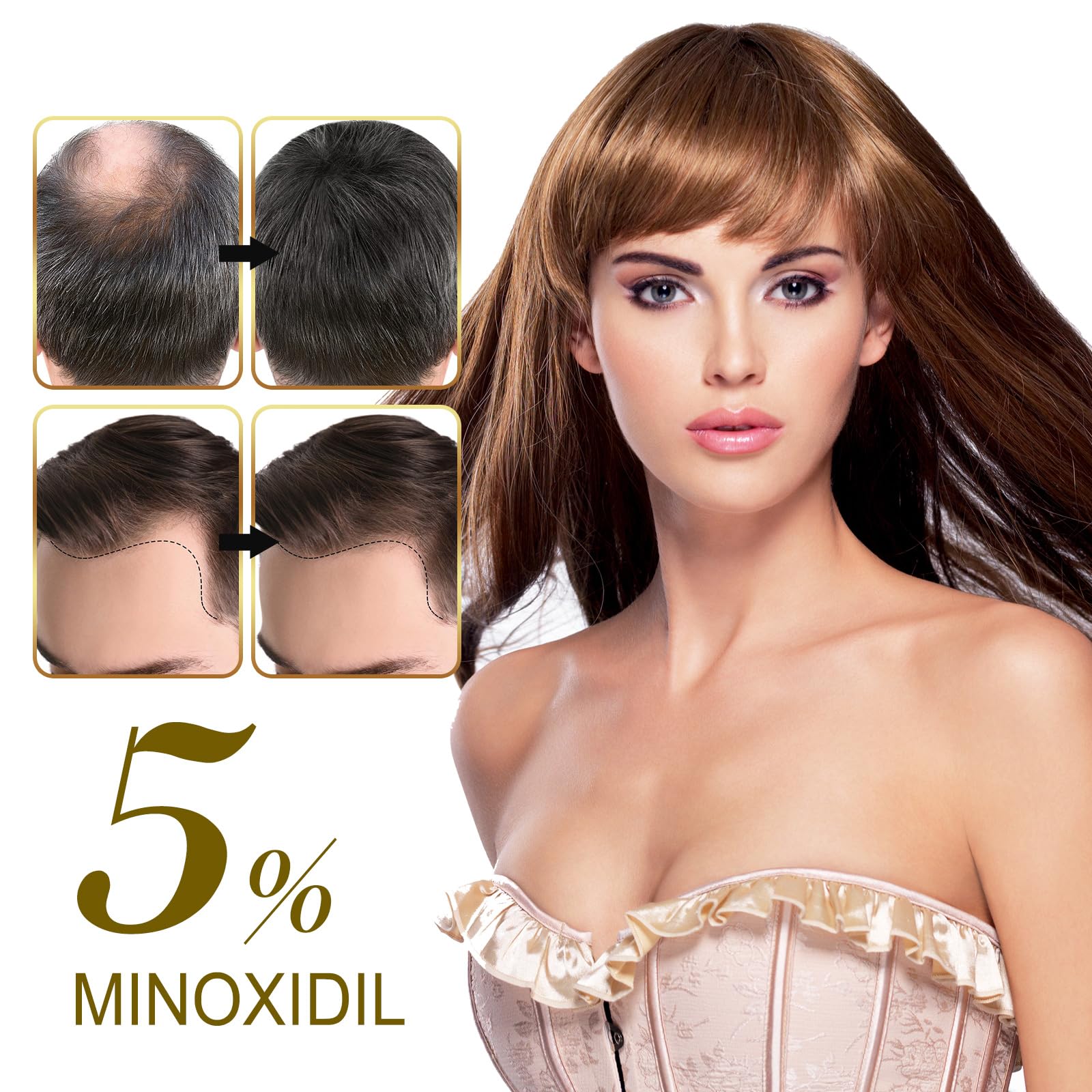 SOLEMEONY 5% Minoxidil Hair Growth Serum - for Stronger Thicker Longer & Hair Reg - SOLEMEONY Official Product View 4