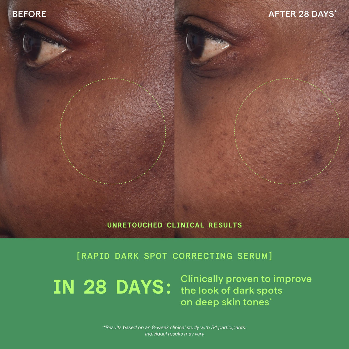 Murad Rapid Dark Spot Correcting Serum - Premium Selection Official Imagery - 7