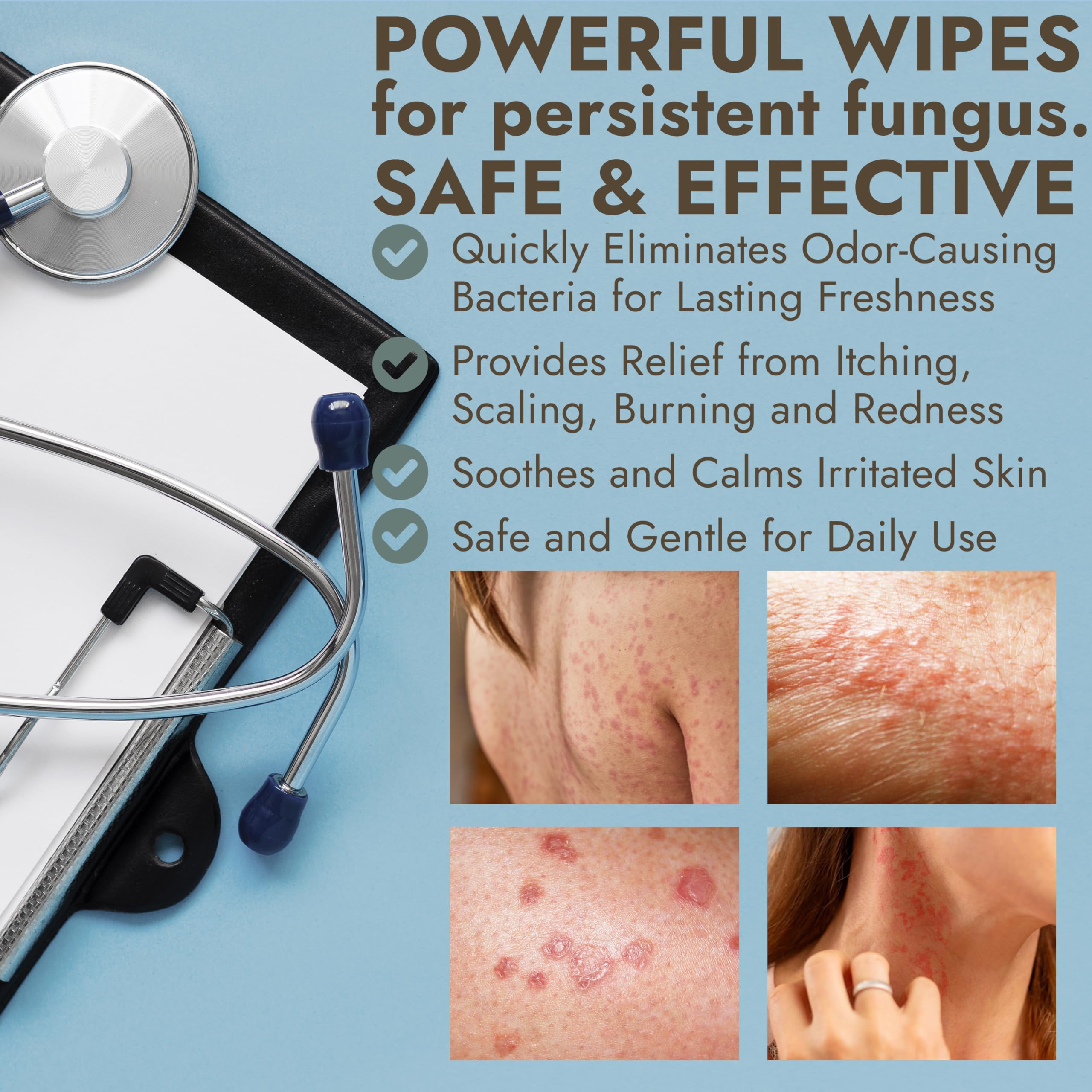 Armor Body Wipes 1% Tolnaftate – Antifungal Cleansing