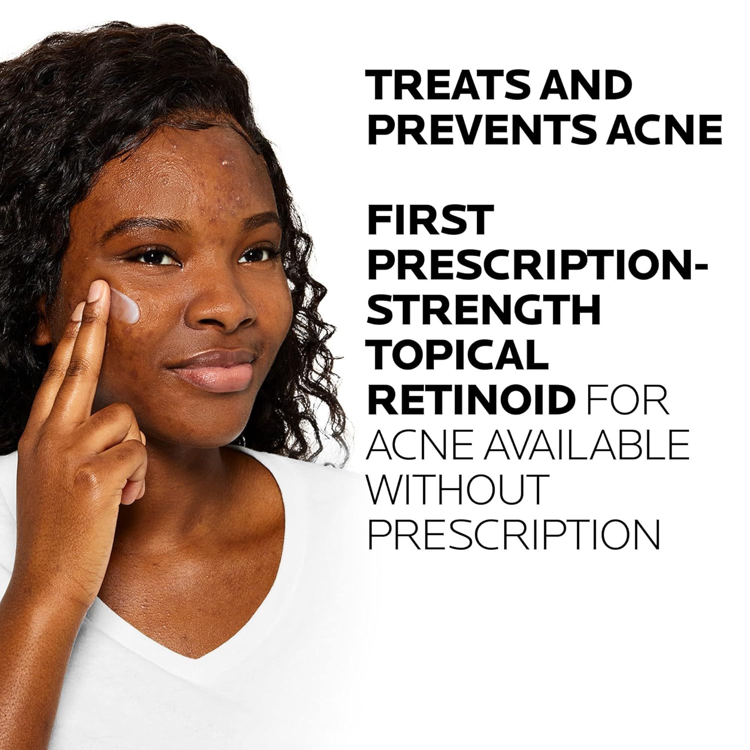 Elefair La Roche-Posay Effaclar Adapalene Gel 0.1% acne treatment retinoid cream for clogged pores, in a tube.