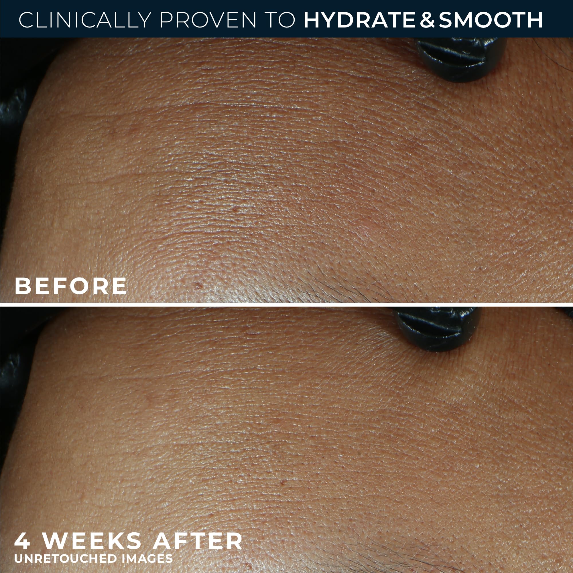 RoC Retinol Correxion Max Daily Hydration Face Moisturizer - RoC Official Imagery - 5