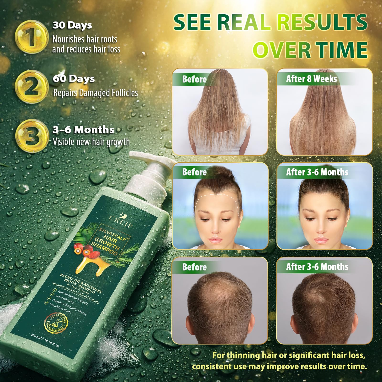 Creip Rosemary & Batana Oil Hair Growth Shampoo - Hair Loss Shampoo and Women - Creip Official Product View 6