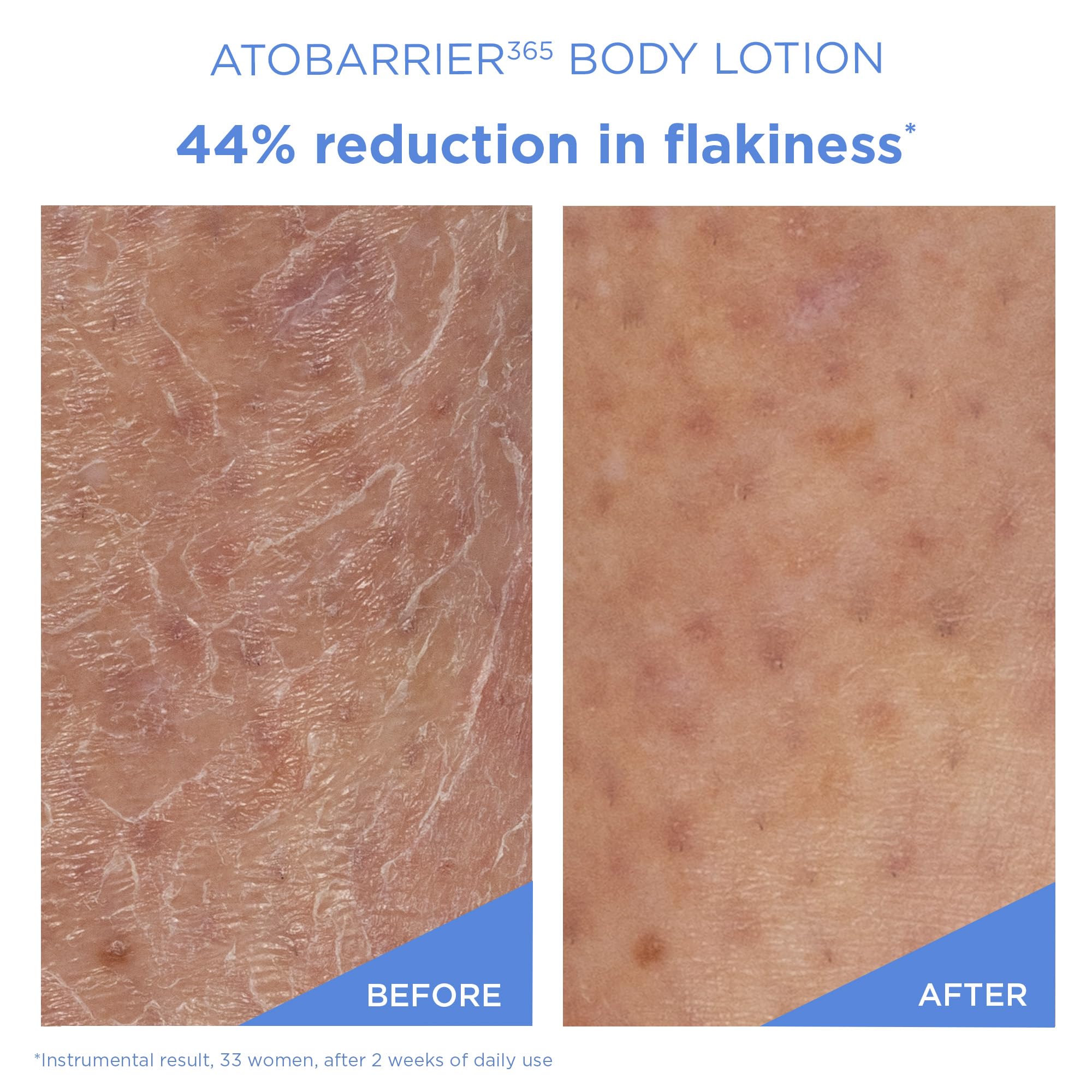 AESTURA ATOBARRIER365 Korean Body Lotion with Ceramides &amp; - AESTURA