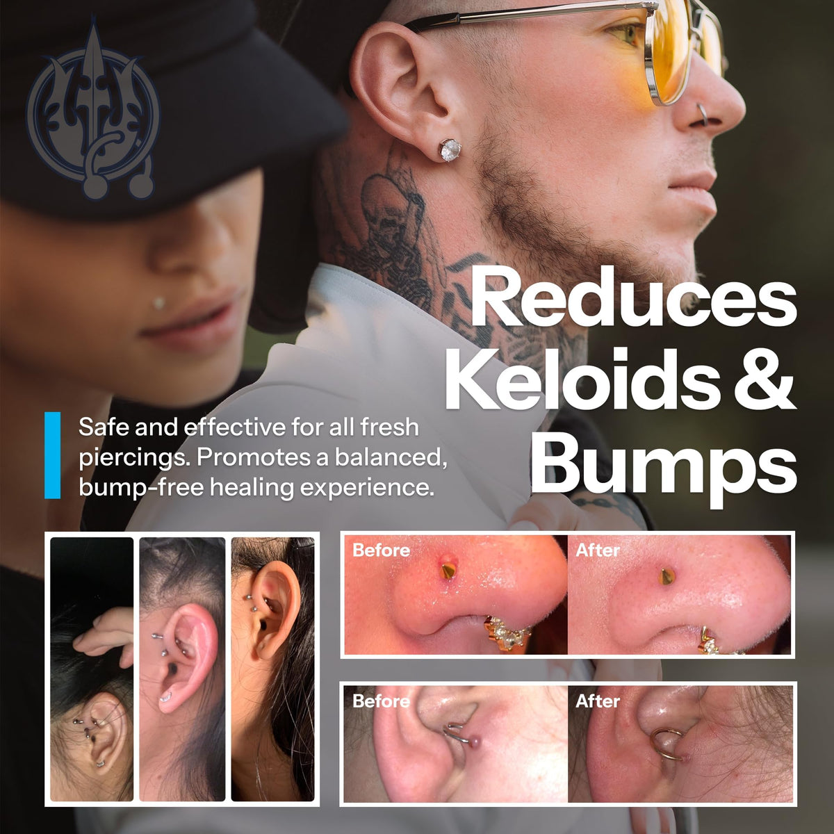 H2Ocean Piercing Aftercare Spray and Keloid Bump Removal Sea - H2Ocean Official Imagery - 7