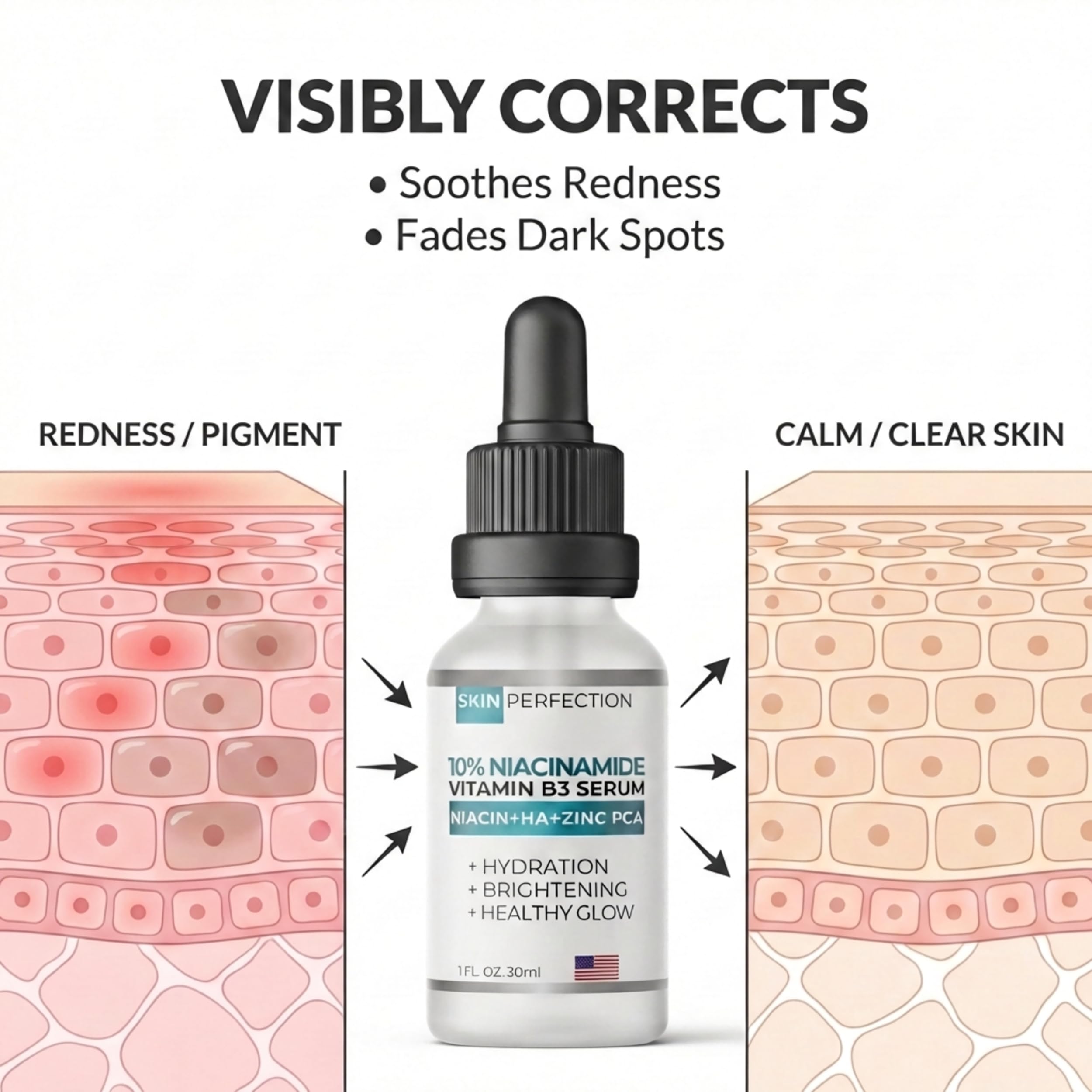 Niacinamide Serum for Face 10% with Zinc, Dark Spot &amp; Pore, - Skin Perfection