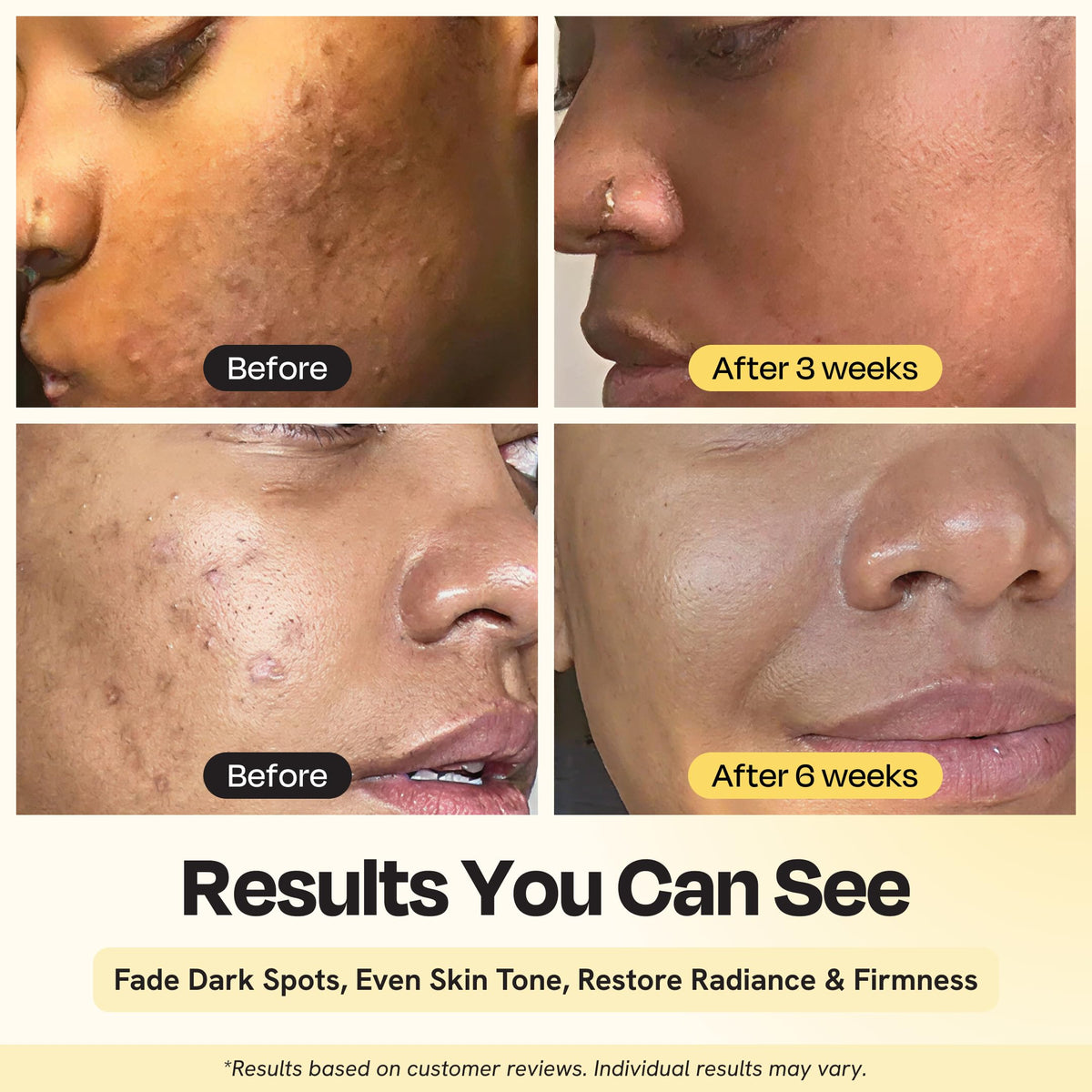 Gleamin Superactive Vitamin C Serum for Face 1 fl oz 15 - Gleamin Official Imagery - 3