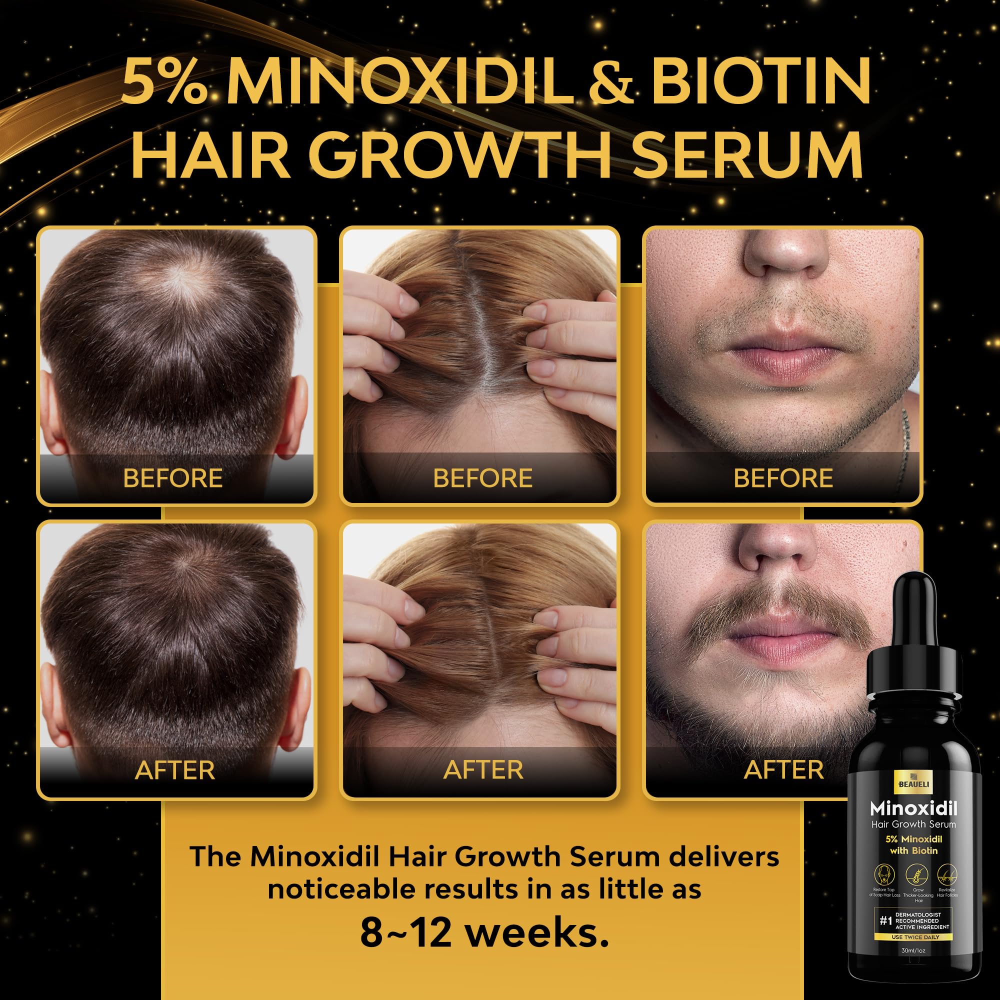 beaueli 5% Minoxidil Hair Growth Serum, Beard Growth Oil - beaueli Official Product View 3