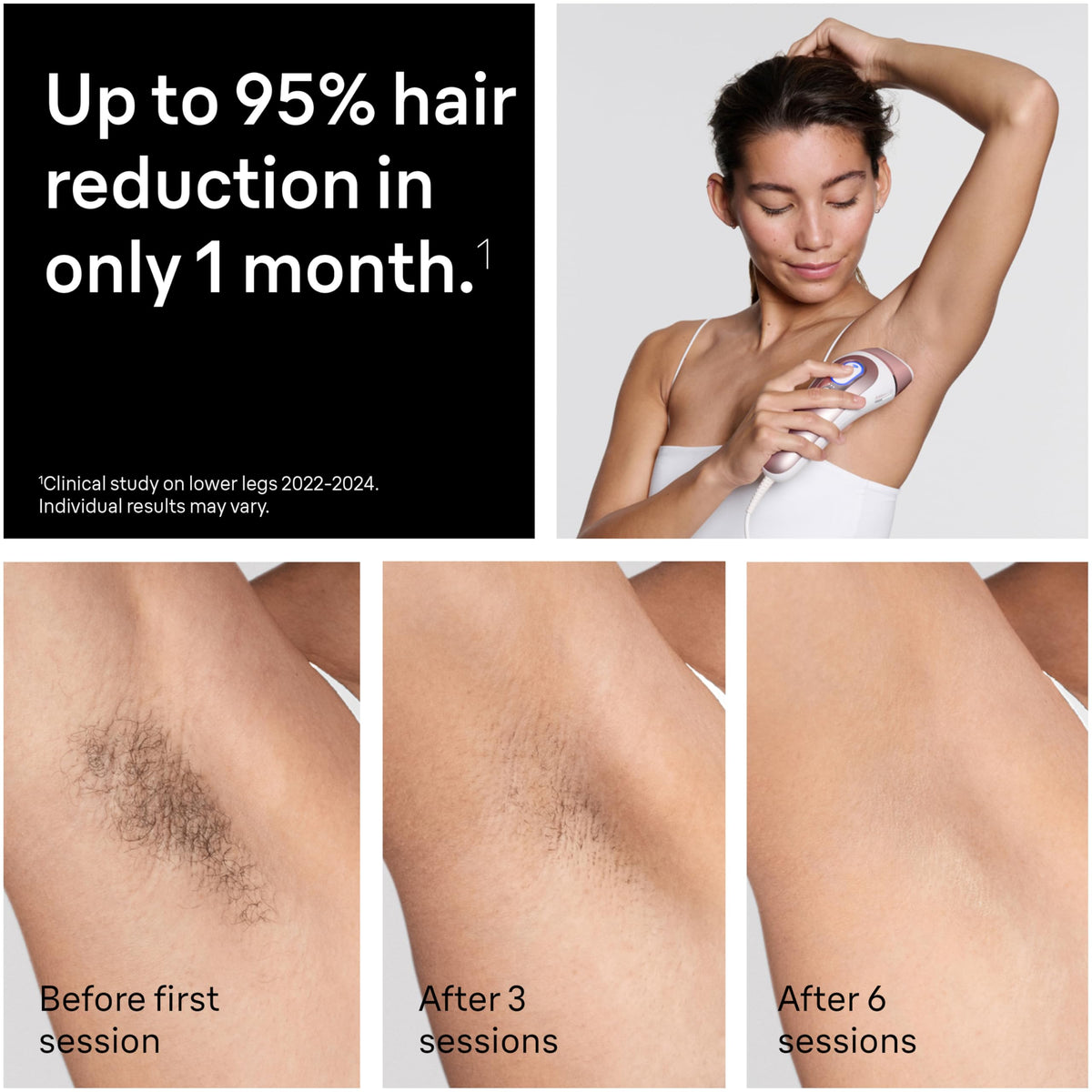 Braun Skin i Expert Smart IPL PL7219 at Home Laser Hair - Braun Official Imagery - 4