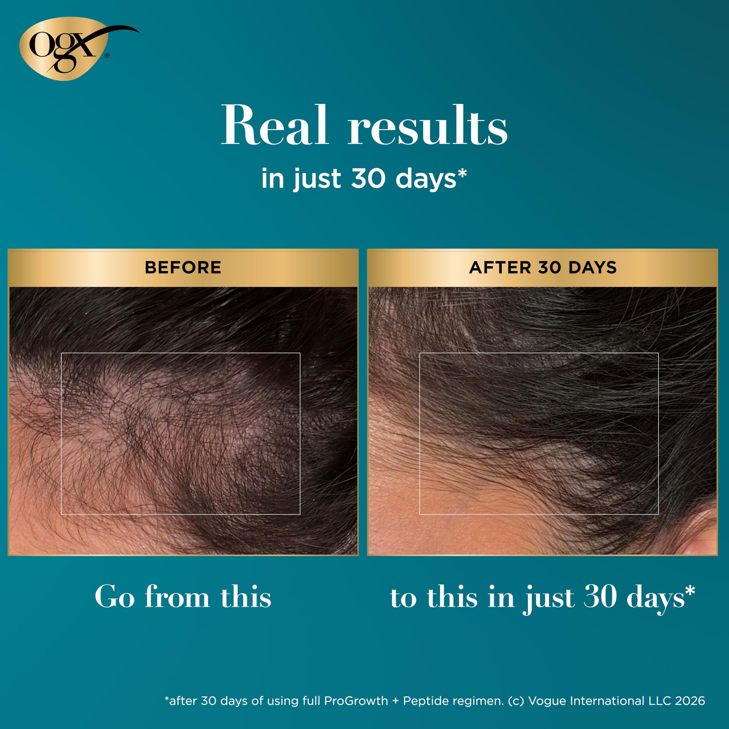 Elefair Tech OGX ProGrowth + Peptide Scalp Serum, 0.33 fl. oz - Elefair Tech Official Product View 8