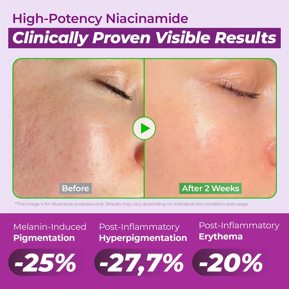 JUMISO 20 Niacinamide Dark Spot Serum 2 Pack TXA Glutathione - JUMISO Official Imagery - 4