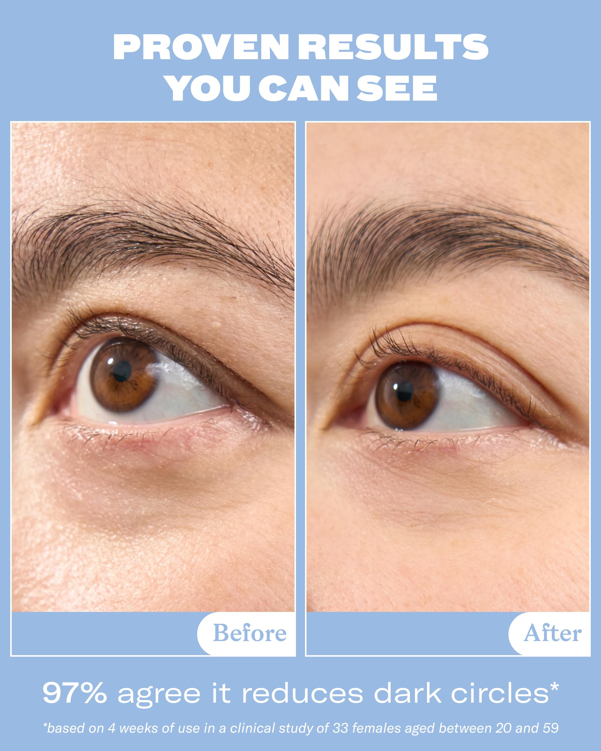 Then I Met You Snail Mucin Eye Cream, With Volufiline - Then I Met You Official Product View 4