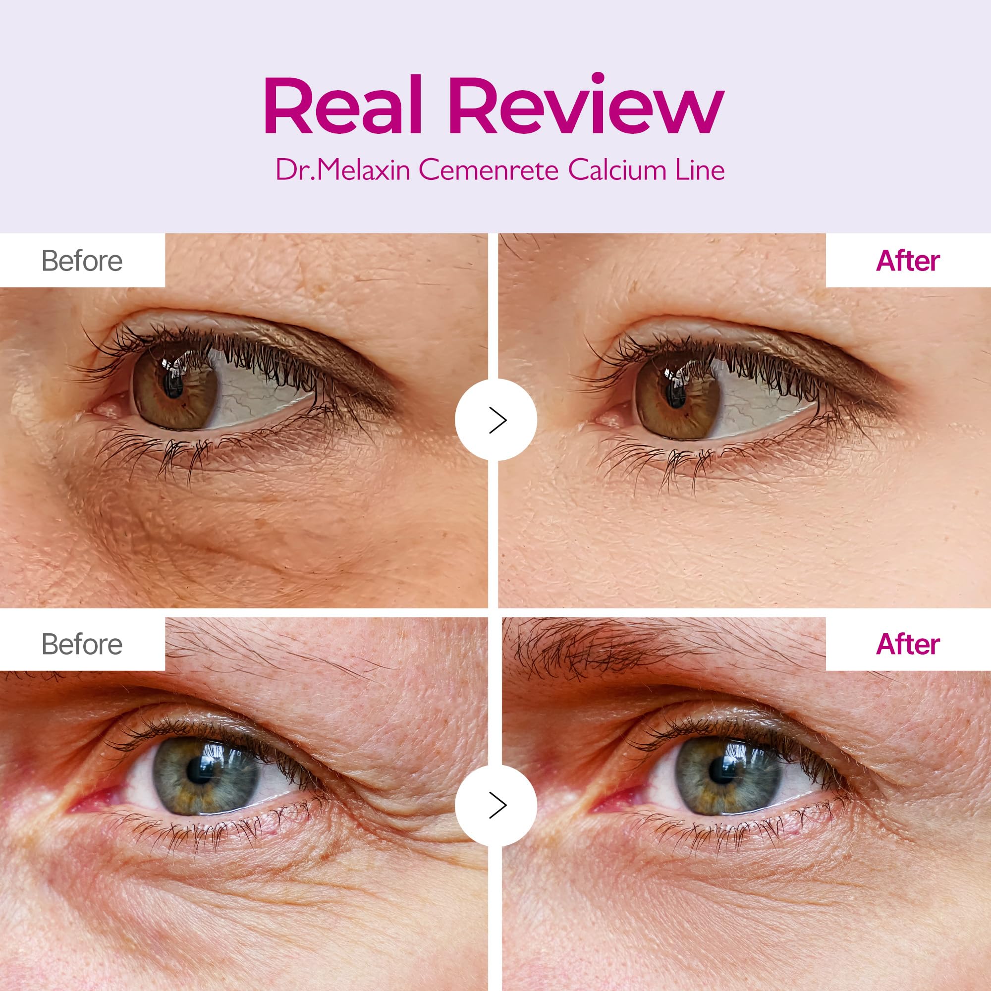 Dr.Melaxin Calcium Volume Under Eye Patches for Puffy Eyes & Dark Circles, Hydrogel Eye Mask for Wrinkles, Fine Lines & Sagging Skin, Firming Collagen Eye Patch, Korean Skin Care (60 Count) - Dr.Melaxin Official Product View 4