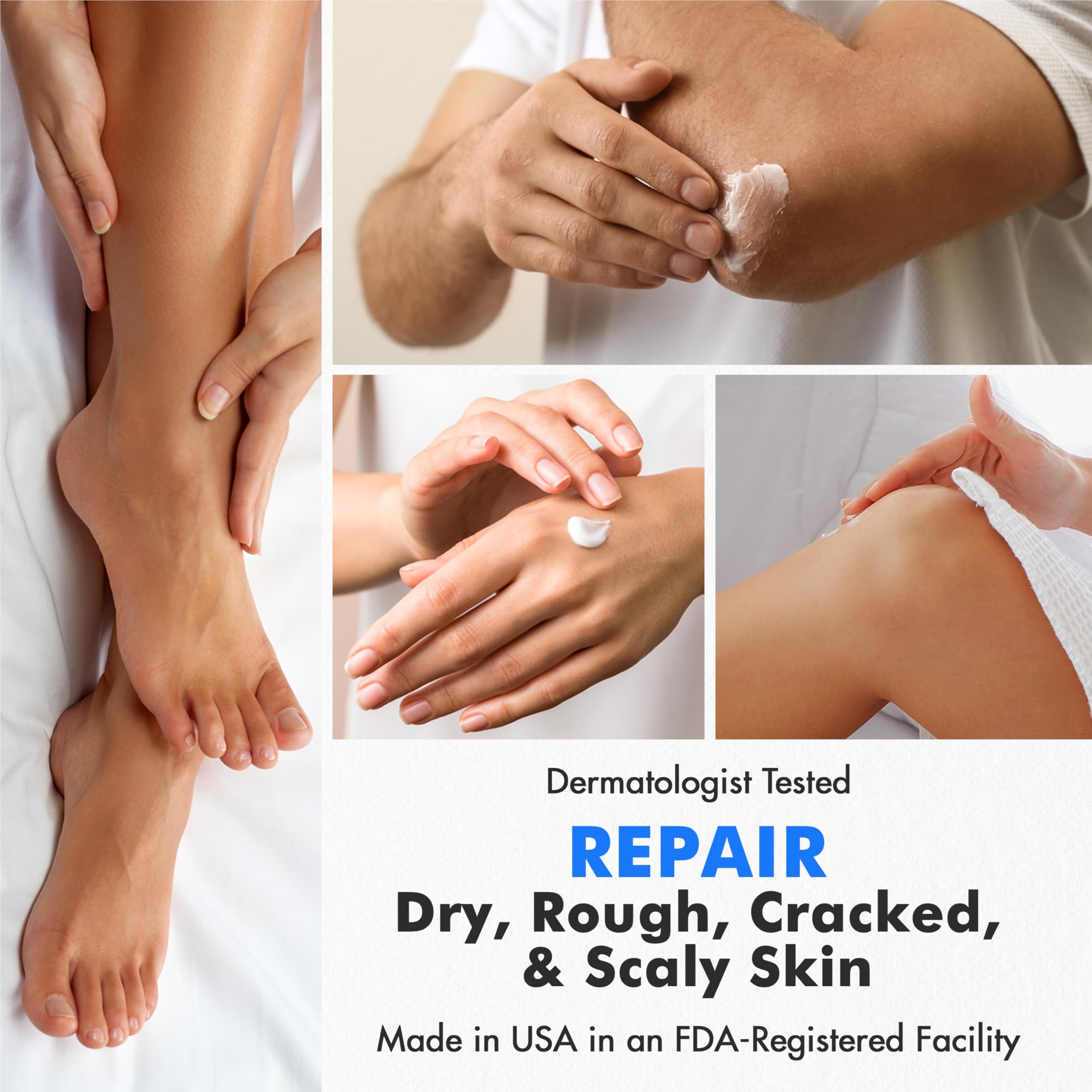 Ebanel Urea 40% cream for dry, cracked feet and heels in a 4oz jar, moisturizing and soothing rough skin.