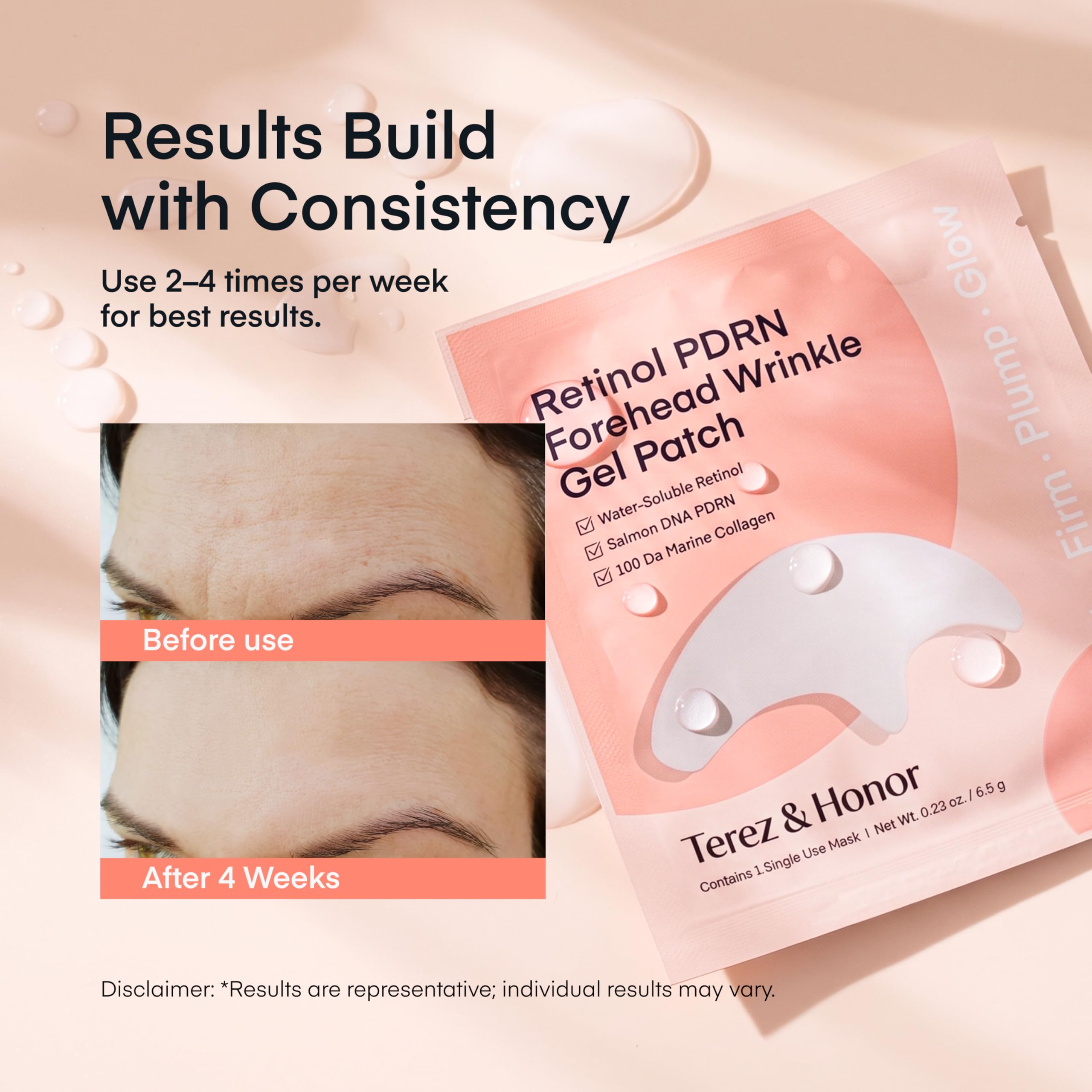 TEREZ &amp; HONOR Retinol PDRN Forehead Wrinkle Patches - TEREZ &amp; HONOR