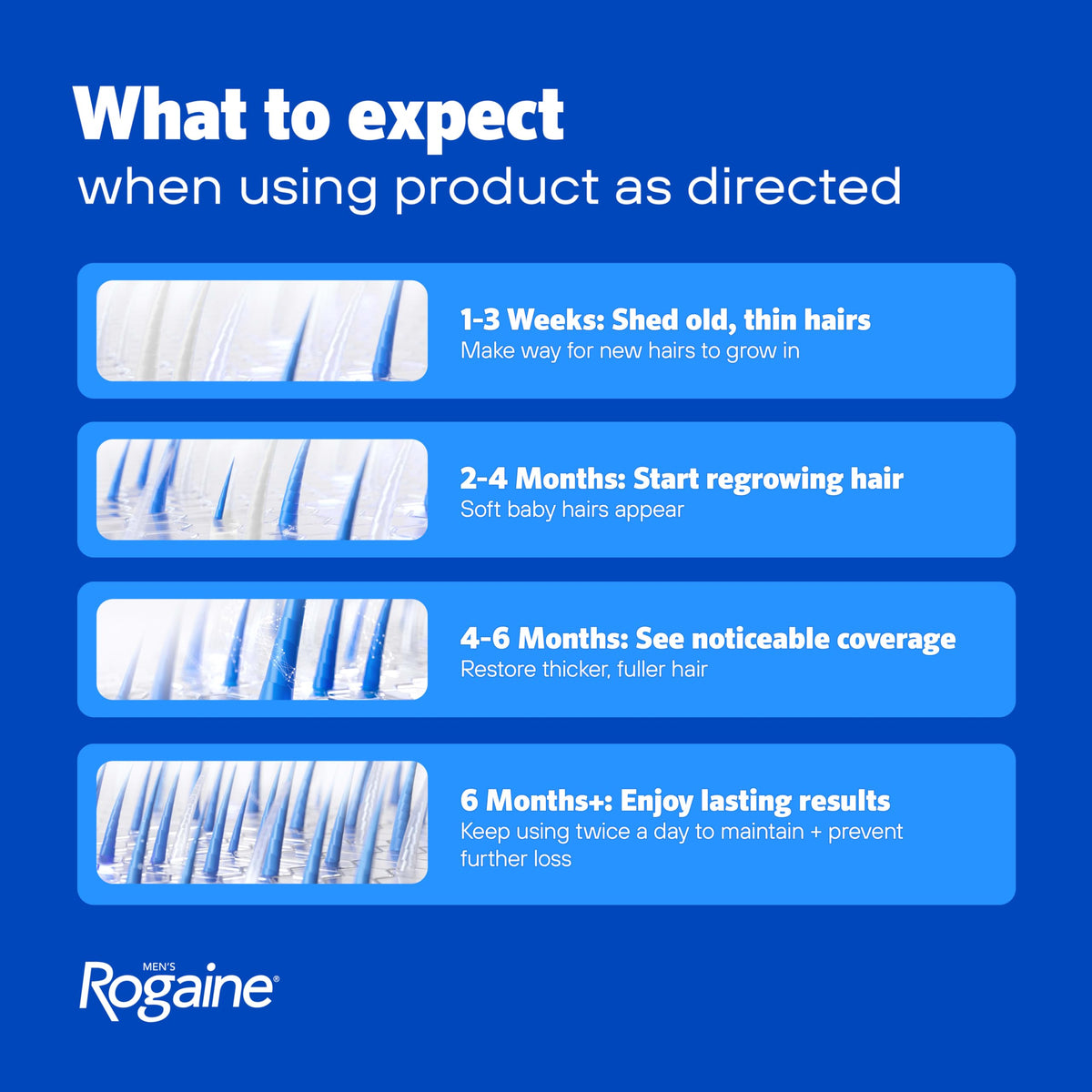 Men s Rogaine Extra Strength 5 Minoxidil Topical Solution 3 - Rogaine Official Imagery - 6