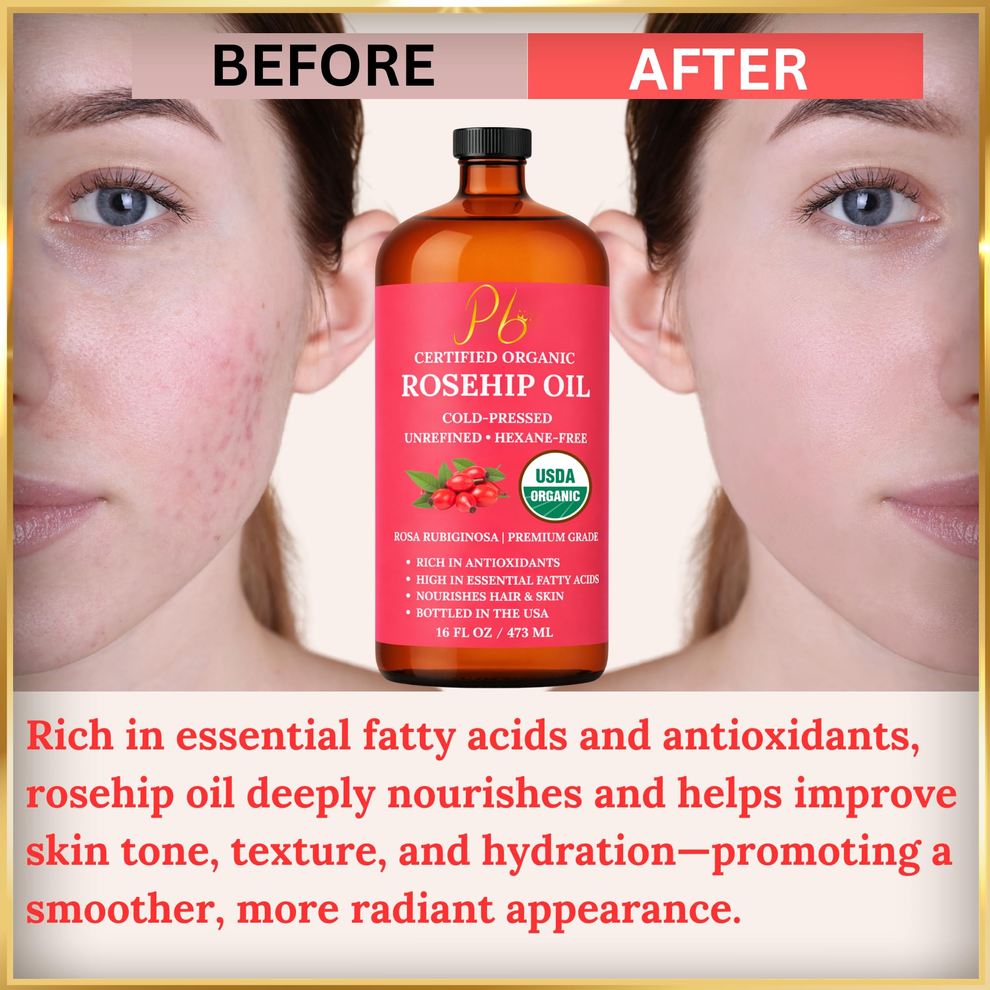 Pomberries Rosehip Oil, 16 fl oz Amber Glass Bottle, Rosehip Oil for Face, Skin - Pomberries Official Product View 9