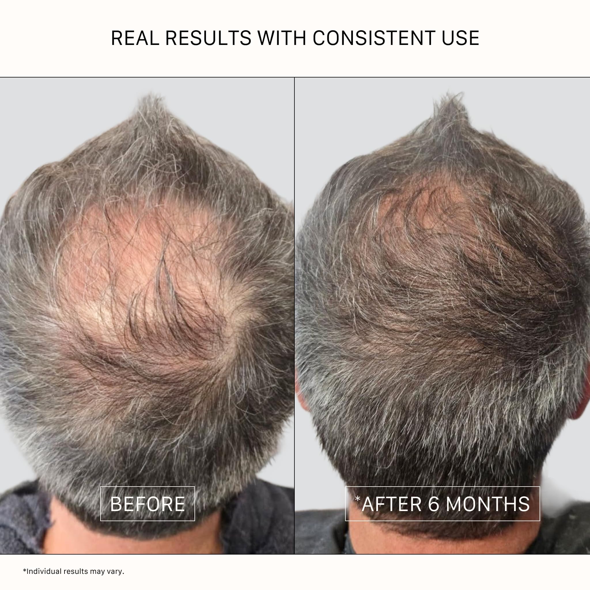 Elefair Tech ACTIIV Recover Unisex Thickening Conditioner - Strengthens & For - Elefair Tech Official Product View 5