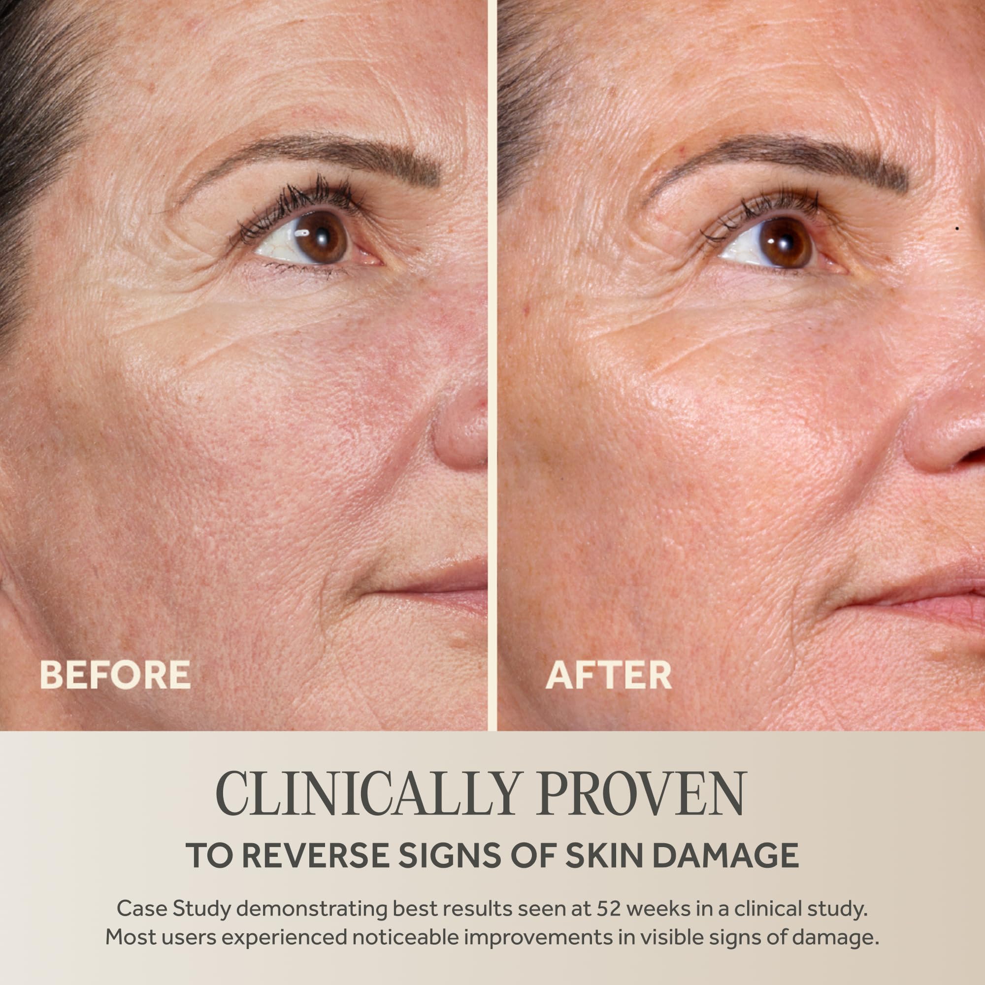 No7 Future Renew Damage Reversal Anti Aging Face Serum 0 84 - No7 Official Imagery - 5