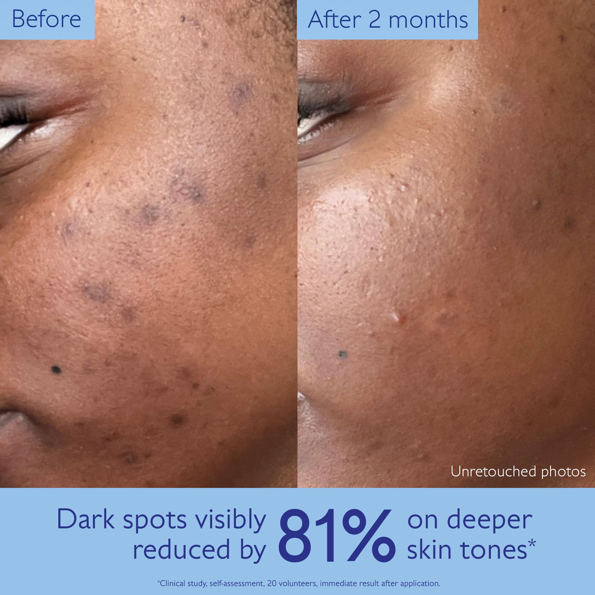 Caudalie Vinoperfect Brightening Dark Spot Serum Vitamin C - Premium Selection Official Imagery - 5