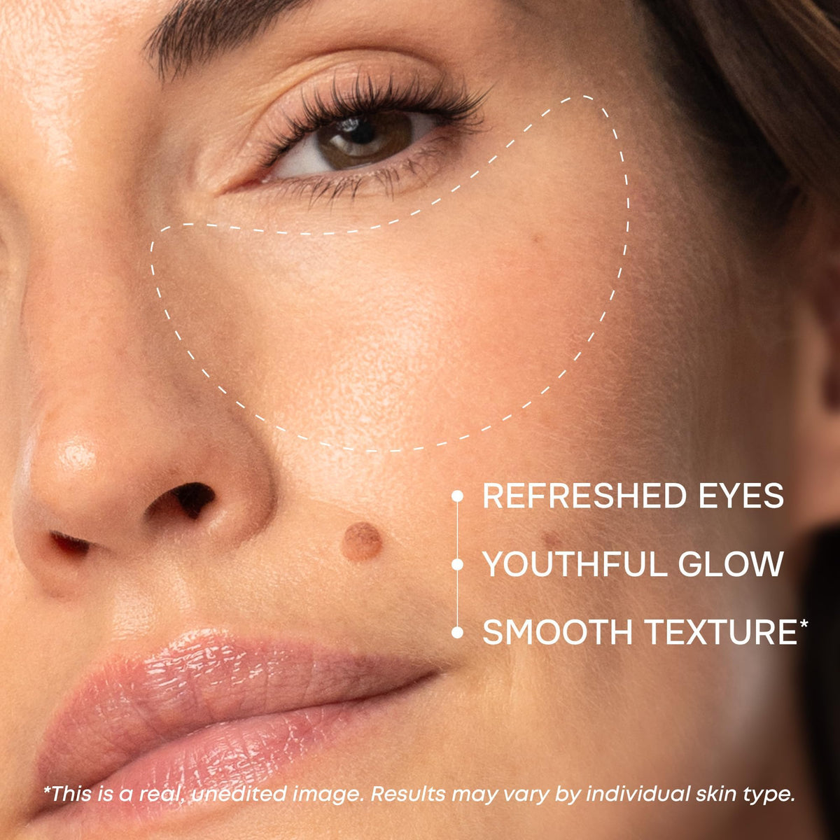 Collagen Eye Patches for Puffy Eyes - SimplyVital Official Imagery - 4