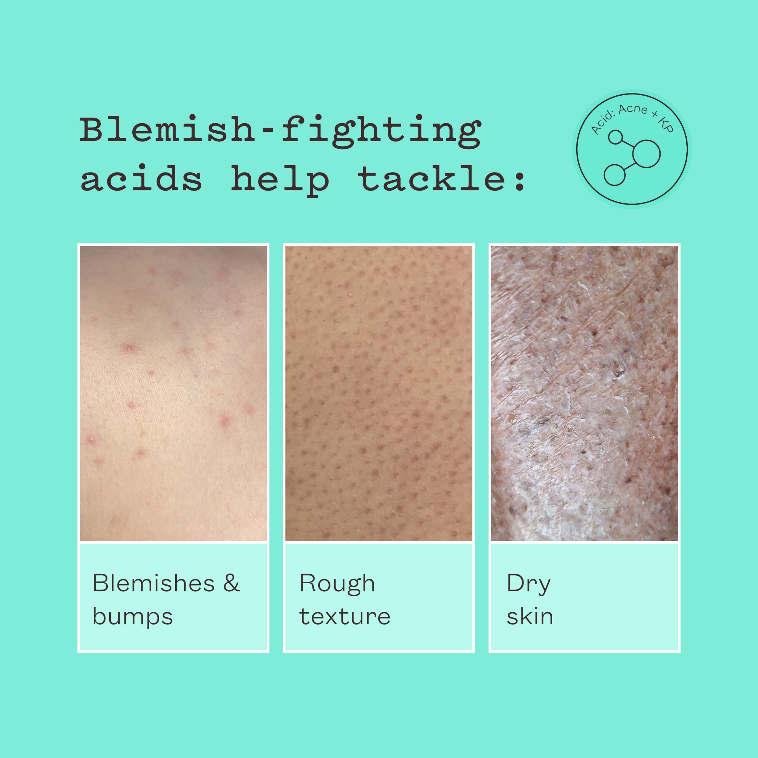 frank body Glycolic Acid Body Scrub - Fights KP & Breakouts & Spots & Tighte - frank body Official Product View 8