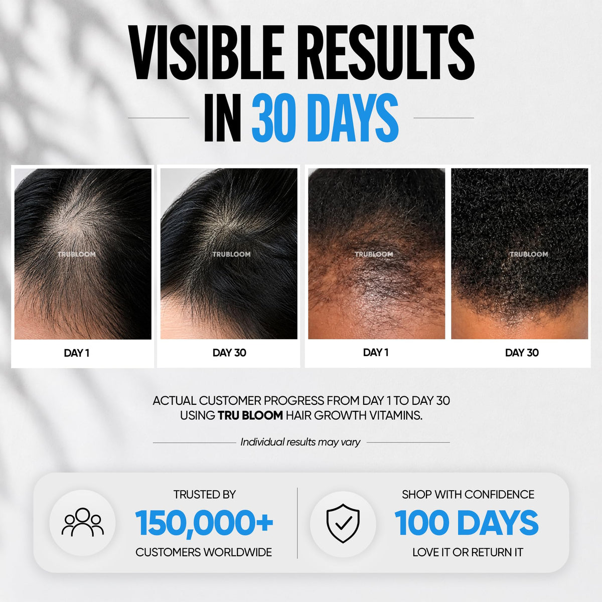 TRU BLOOM Hair Vitamins for Women and Men - TRU BLOOM Official Imagery - 3