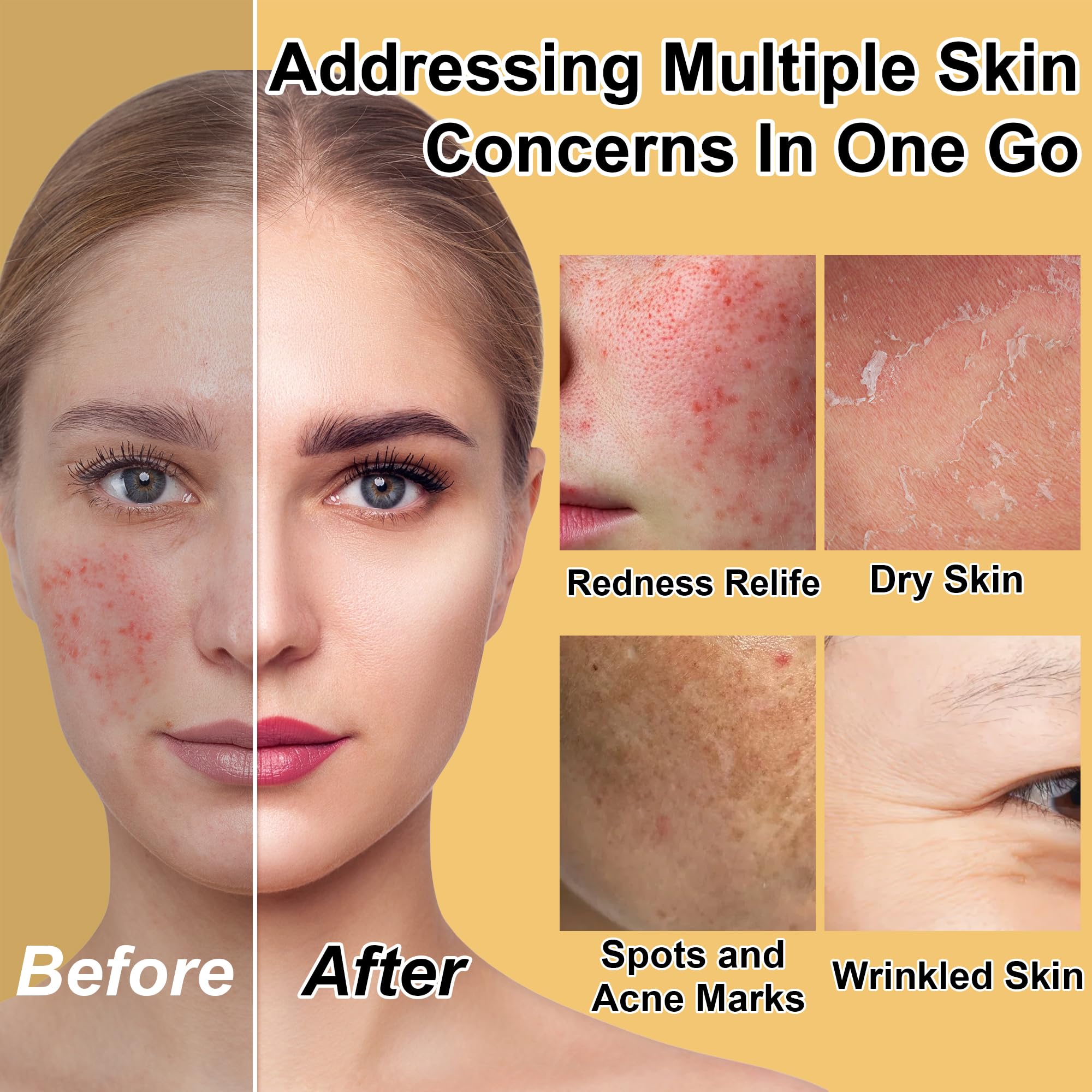 Skin Care Set for Teens Womens,Anti-Aging Deeply Hydrates - GOWLAVER
