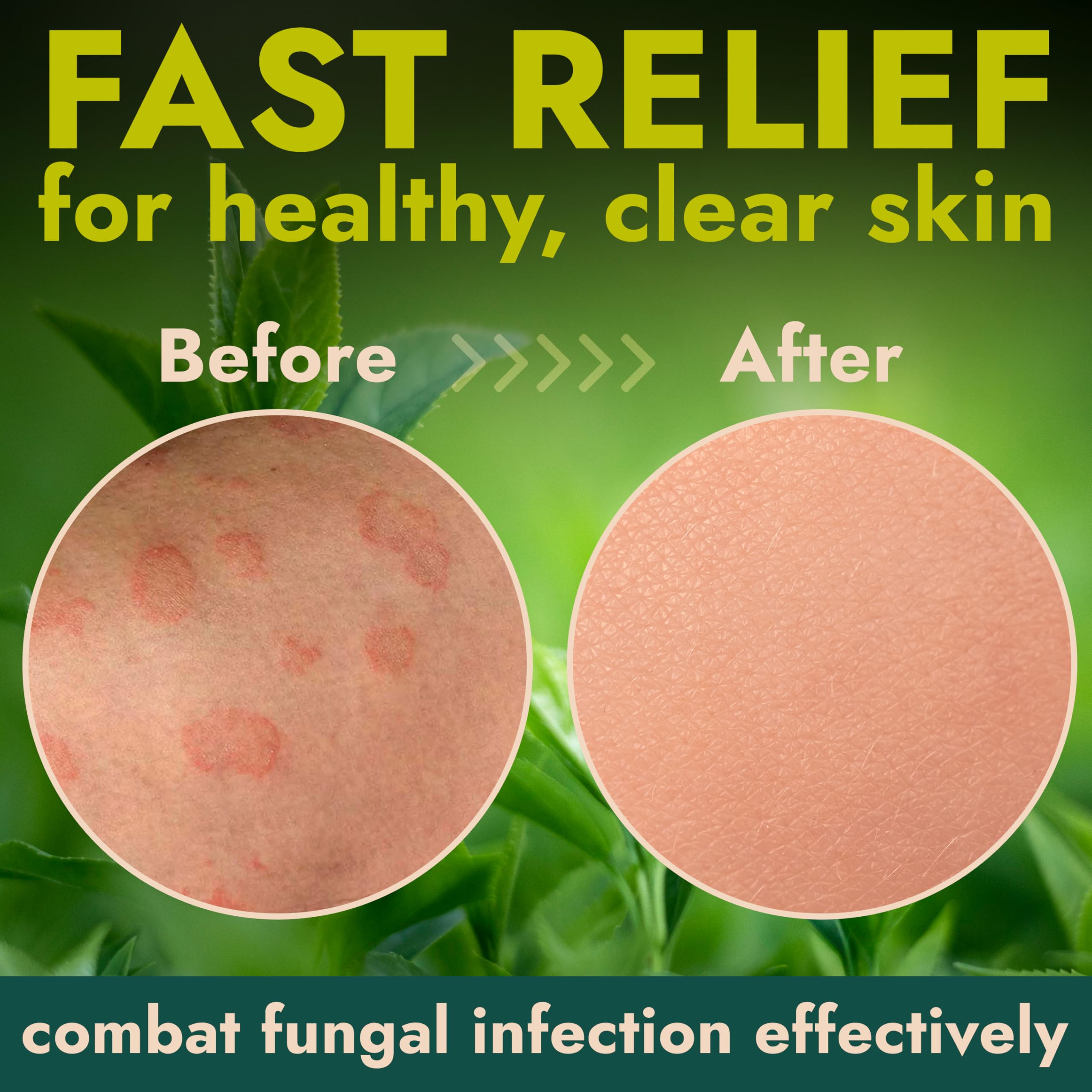 Armor Body Wipes 1% Tolnaftate – Antifungal Cleansing