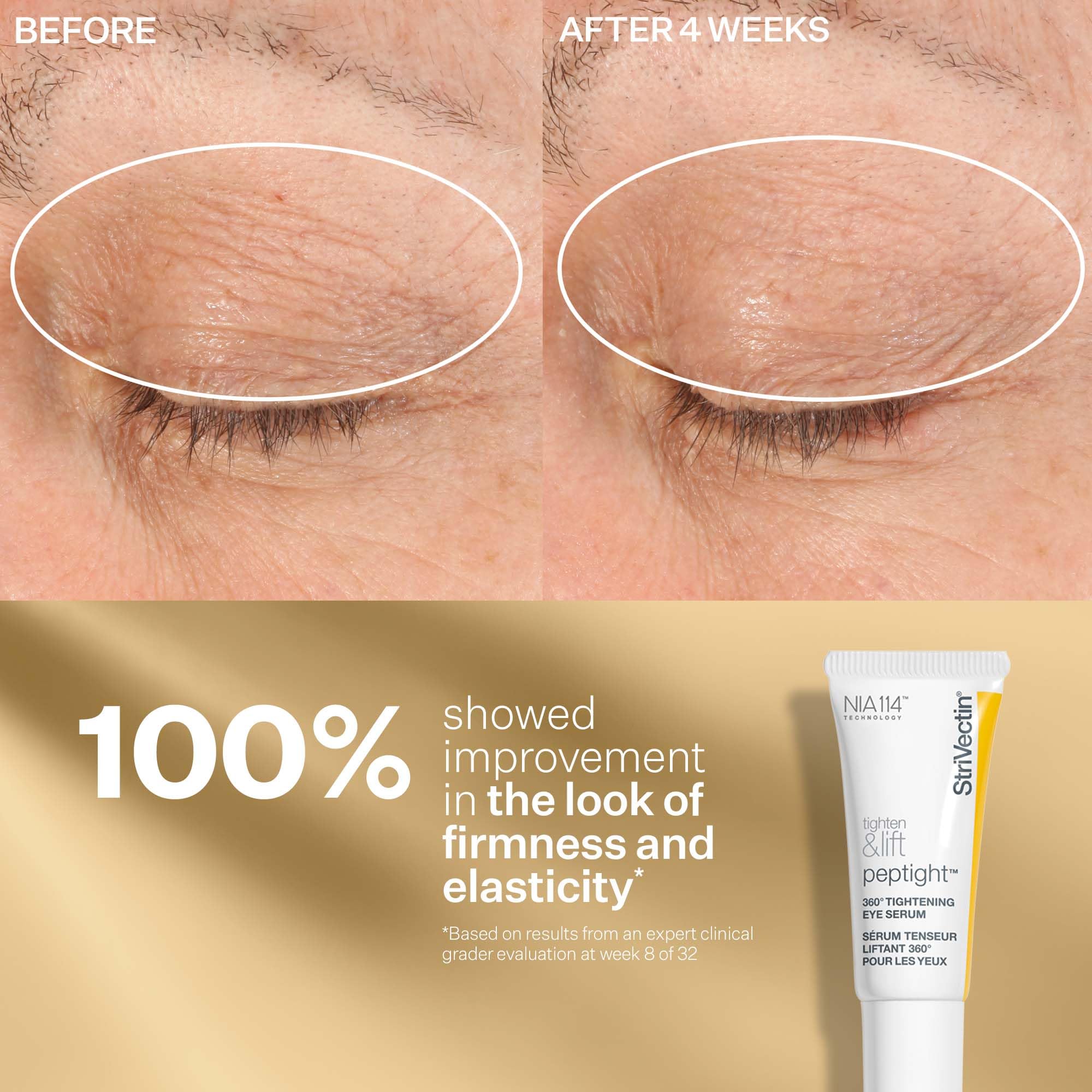 StriVectin Tighten Lift Peptight Face Lift Serum with - Premium Selection Official Imagery - 6